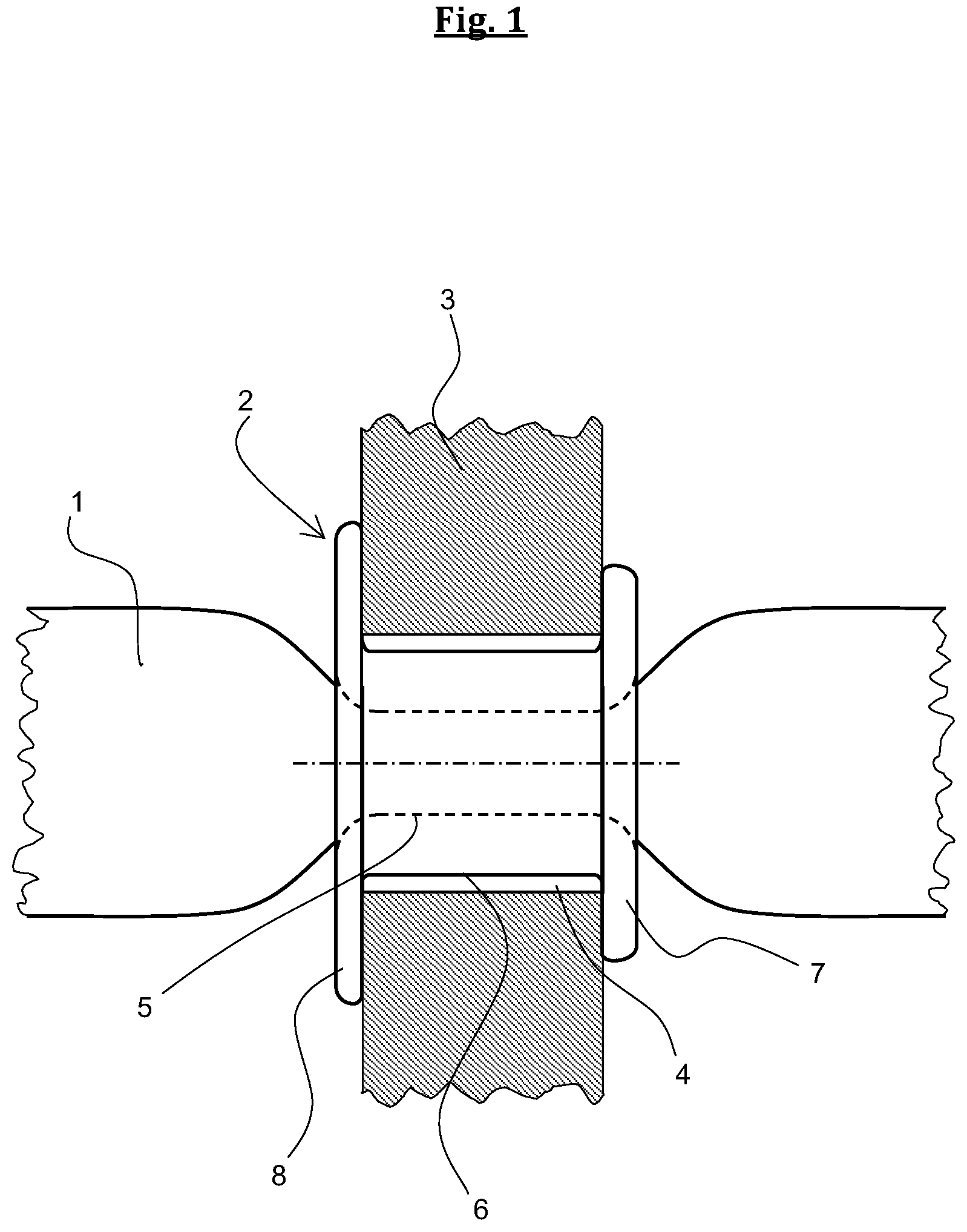 Patent US12137776 — Shoe equipped with a shoelace — Figure 1