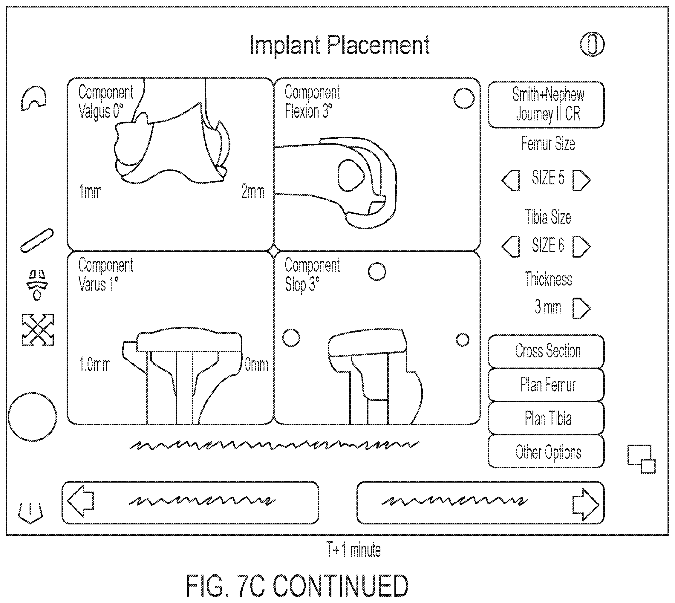 Patent US12137883 Figure 12 – User interface for digital markers in arthroscopy