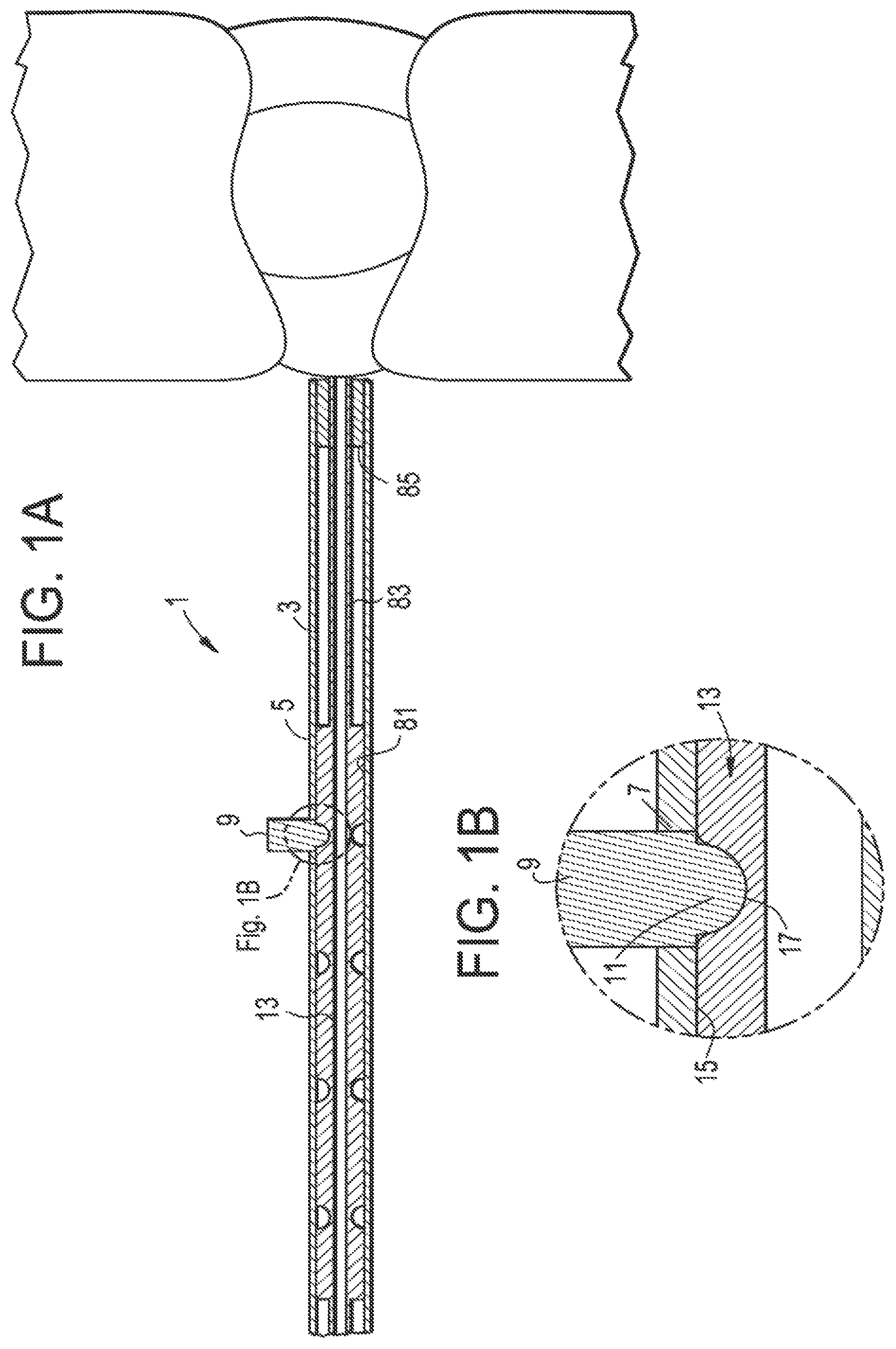 Patent US12137891 — Intervertebral disc puncture and treatment system — Figure 1