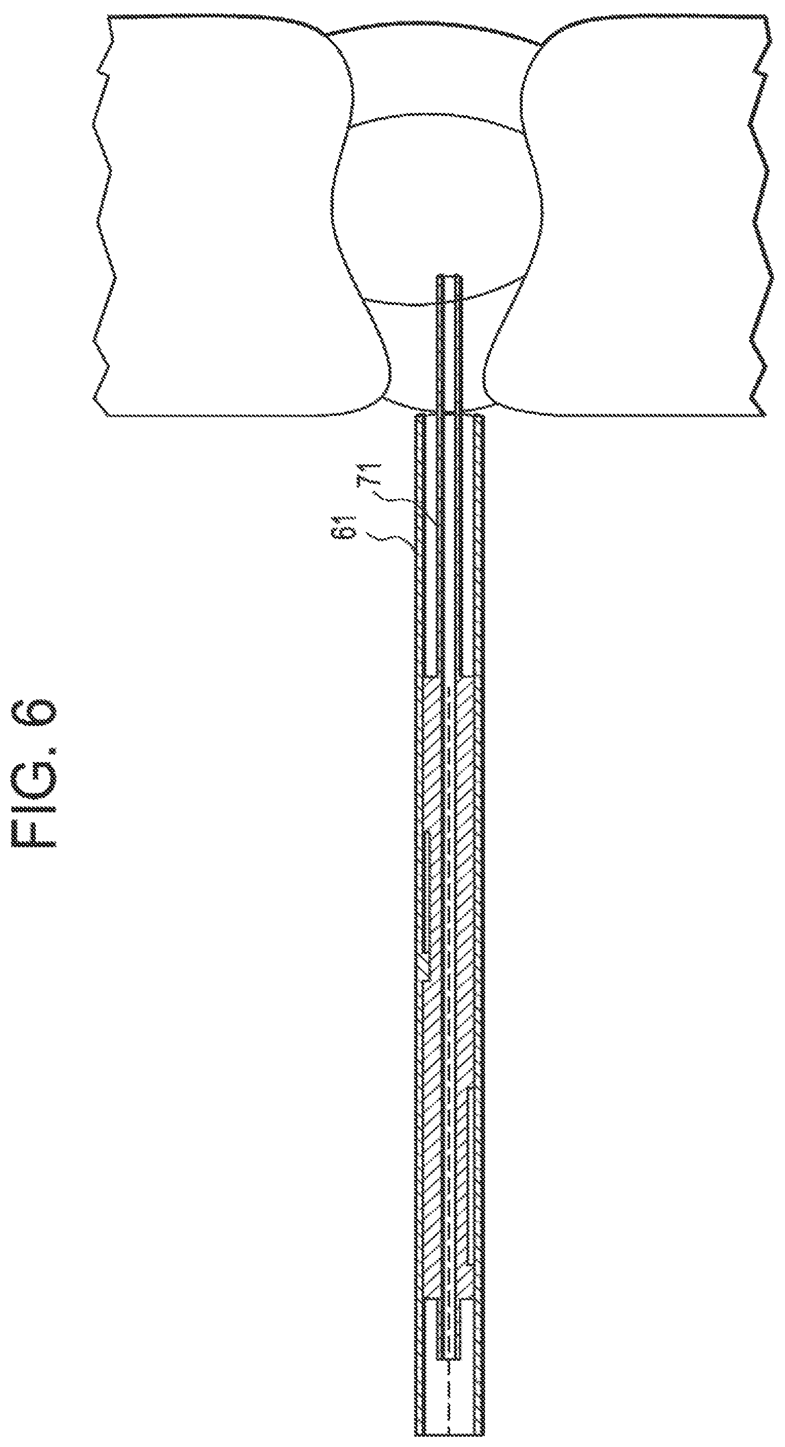 Patent US12137891 Figure 6 – Intervertebral disc puncture and treatment system