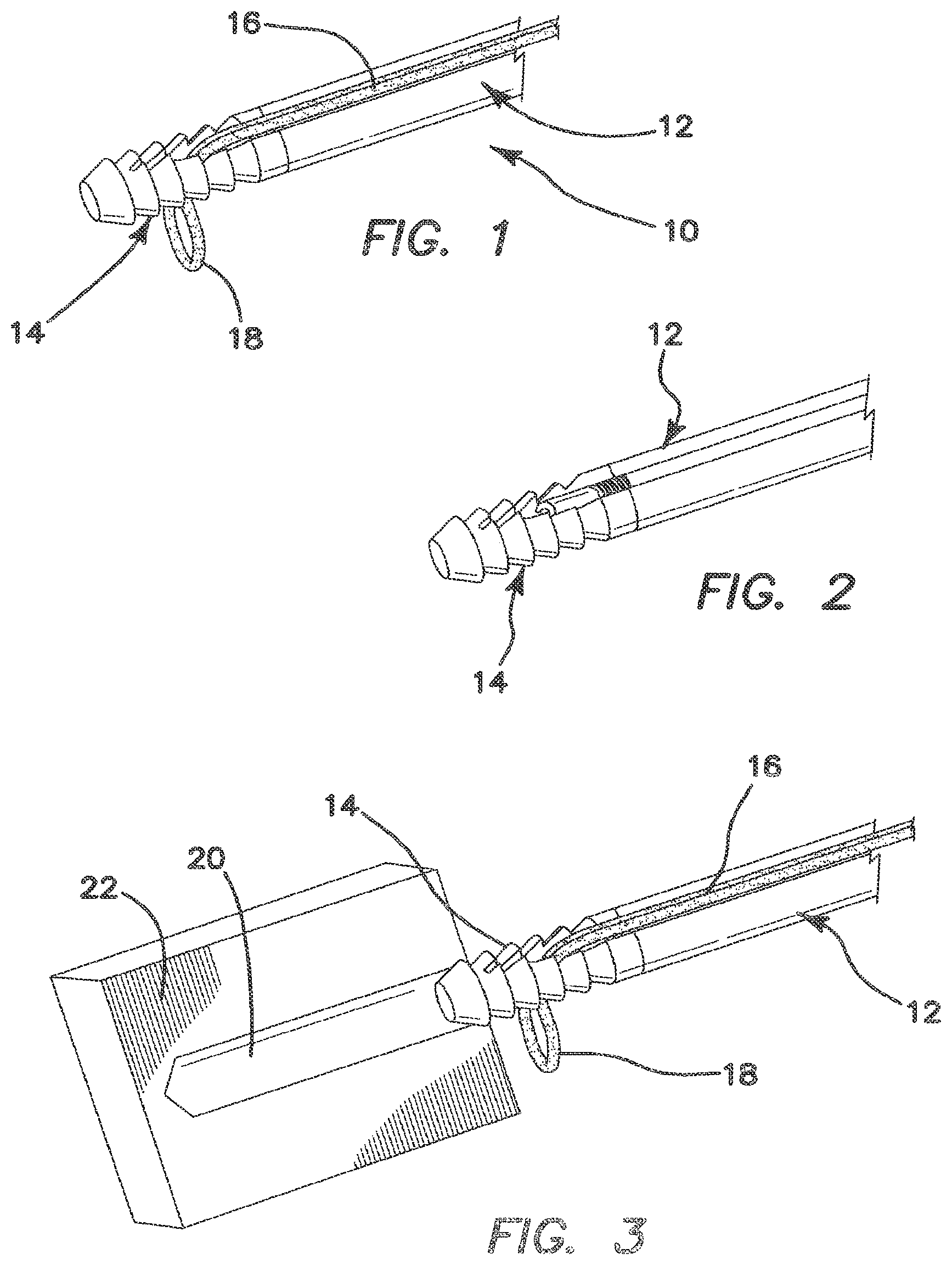 Patent US12137895 — Anchors and methods for securing suture to bone — Figure 1