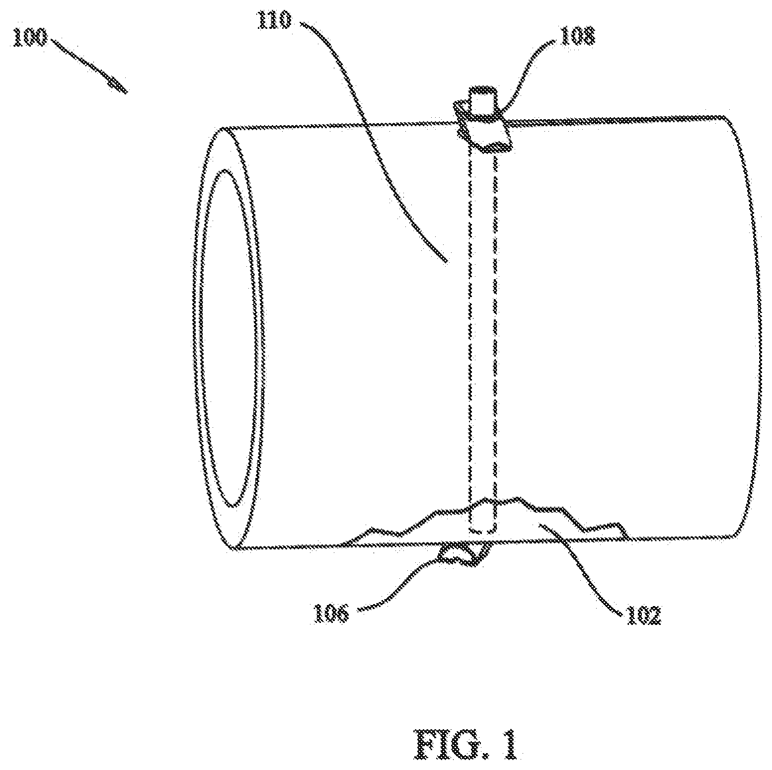 Patent US12137898 — Tissue fixation system and method — Figure 1
