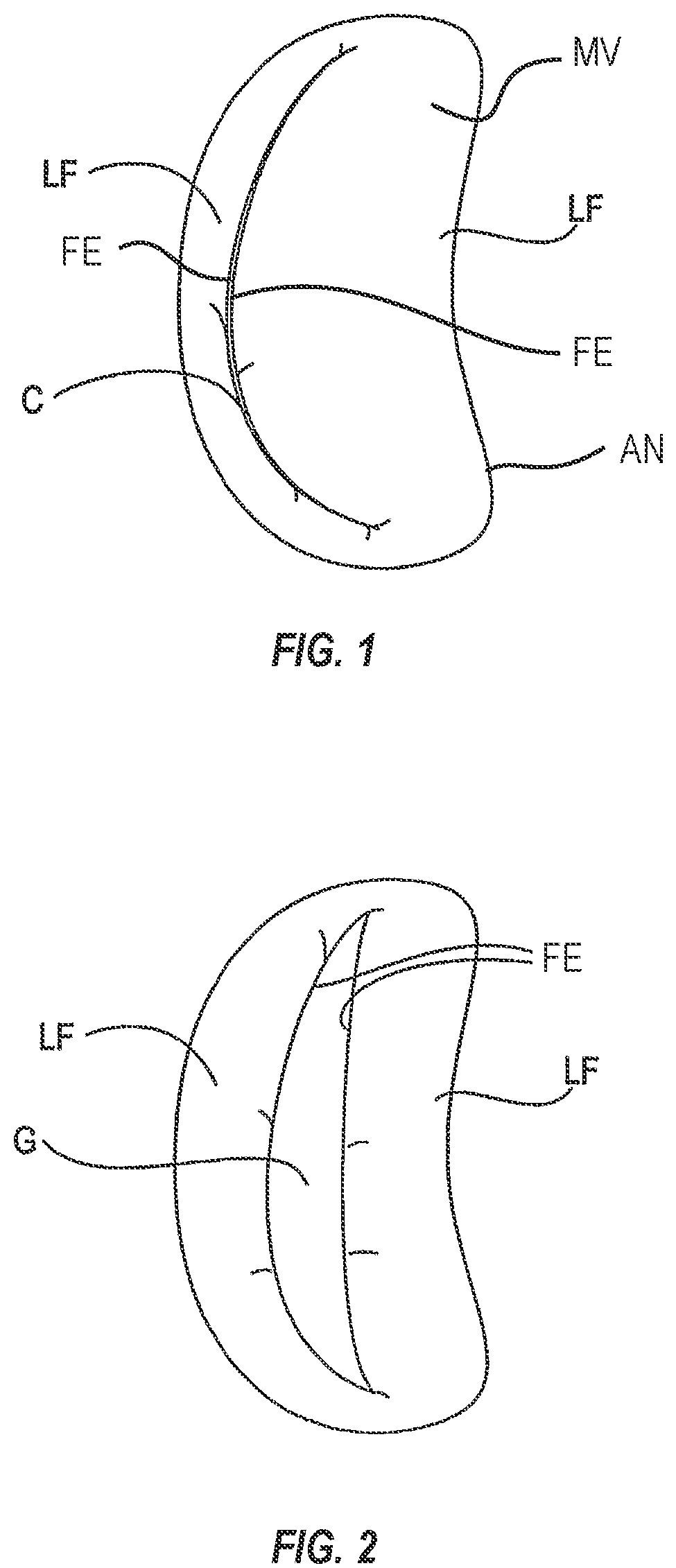 Patent US12137909 Figure 1 – Grasping for tissue repair