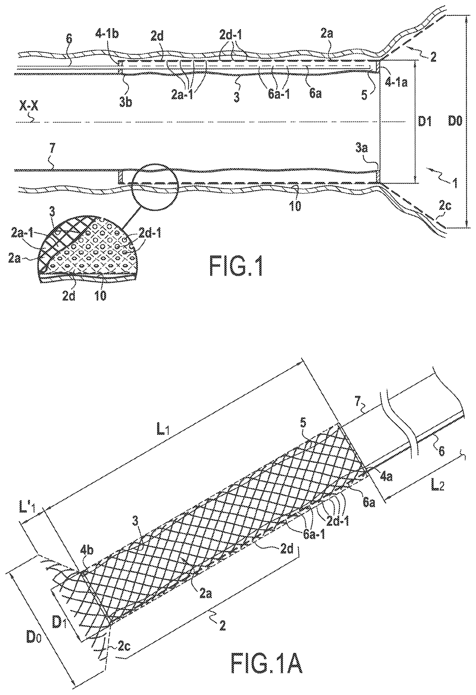 Patent US12137911 — Surgical device for controlled anchoring in the intestine — Figure 1