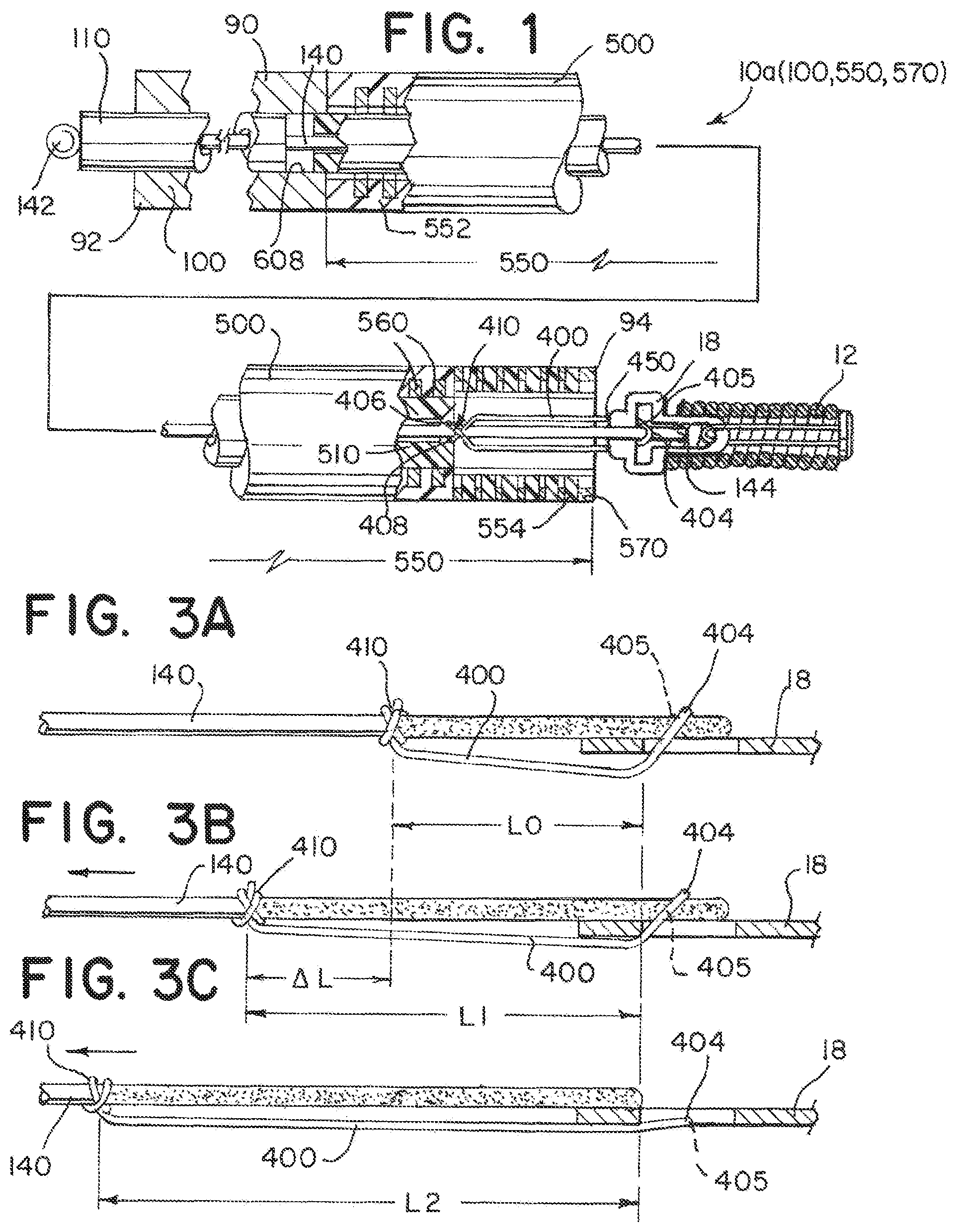 Patent US12137915 — Elongating wires for inhibiting premature implant detachment — Figure 1