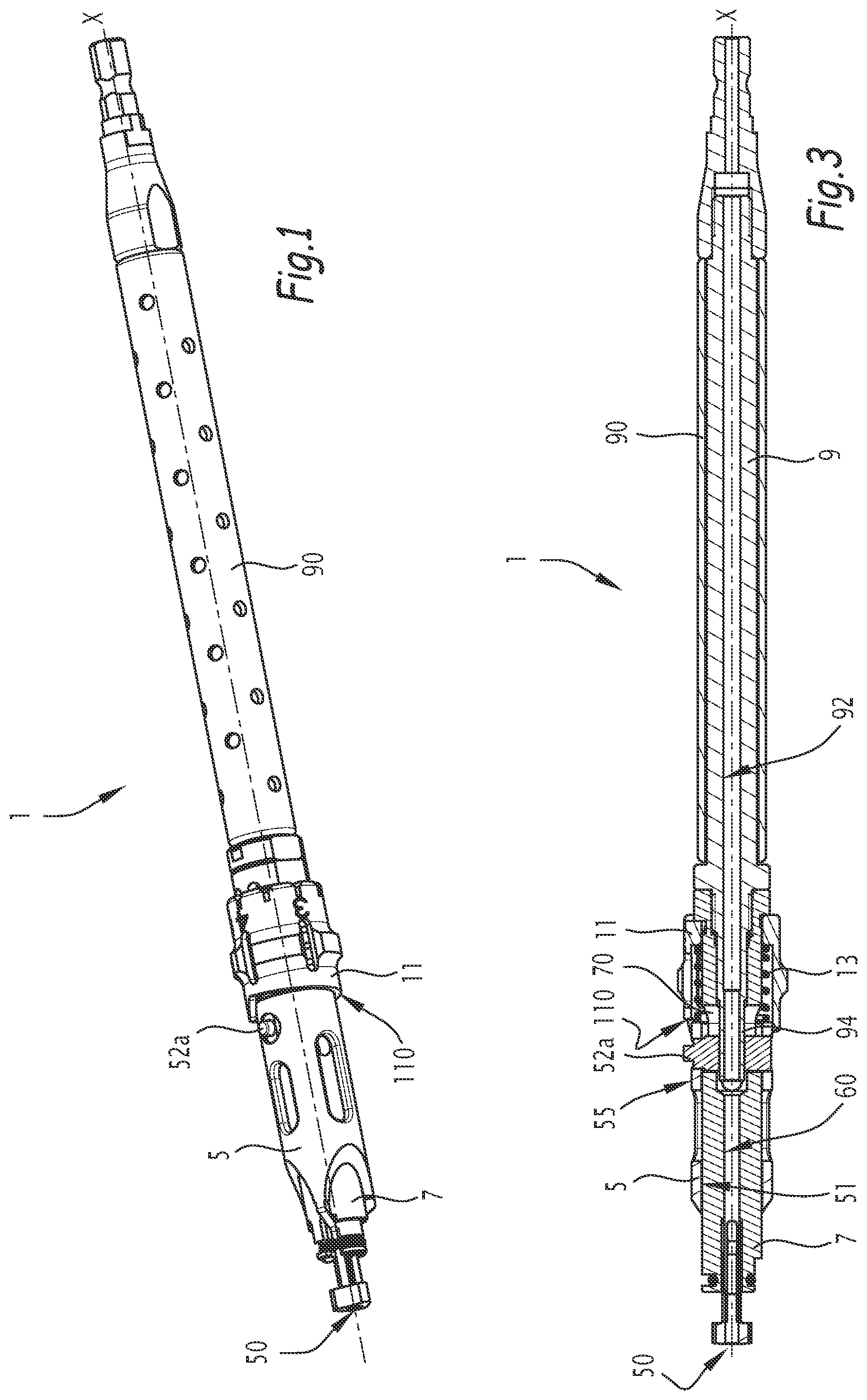 Patent US12137921 Figure 1 – Surgical bone preparation instrument and assembly comprising such an instrument