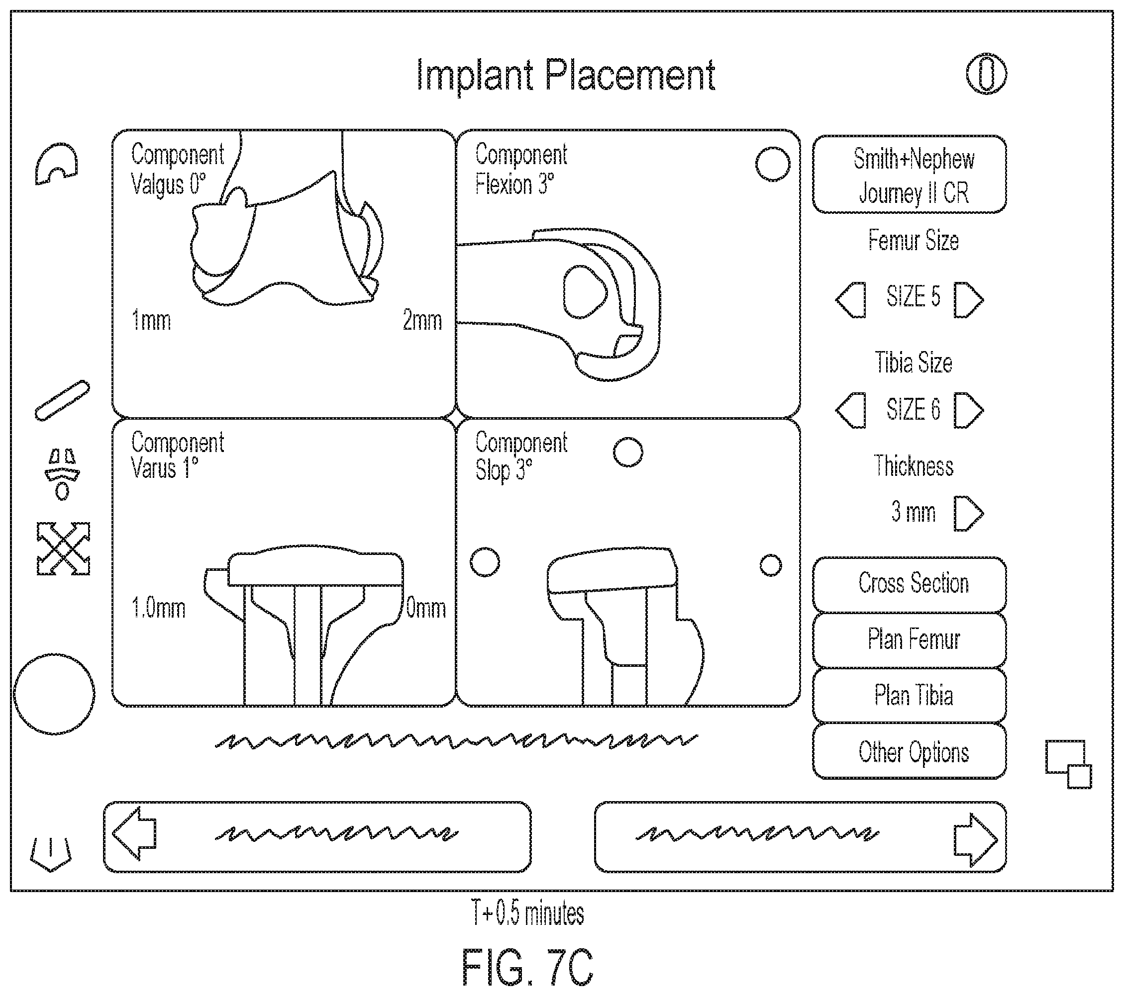 Patent US12137922 Figure 11 – Patient-specific guides for Latarjet procedure