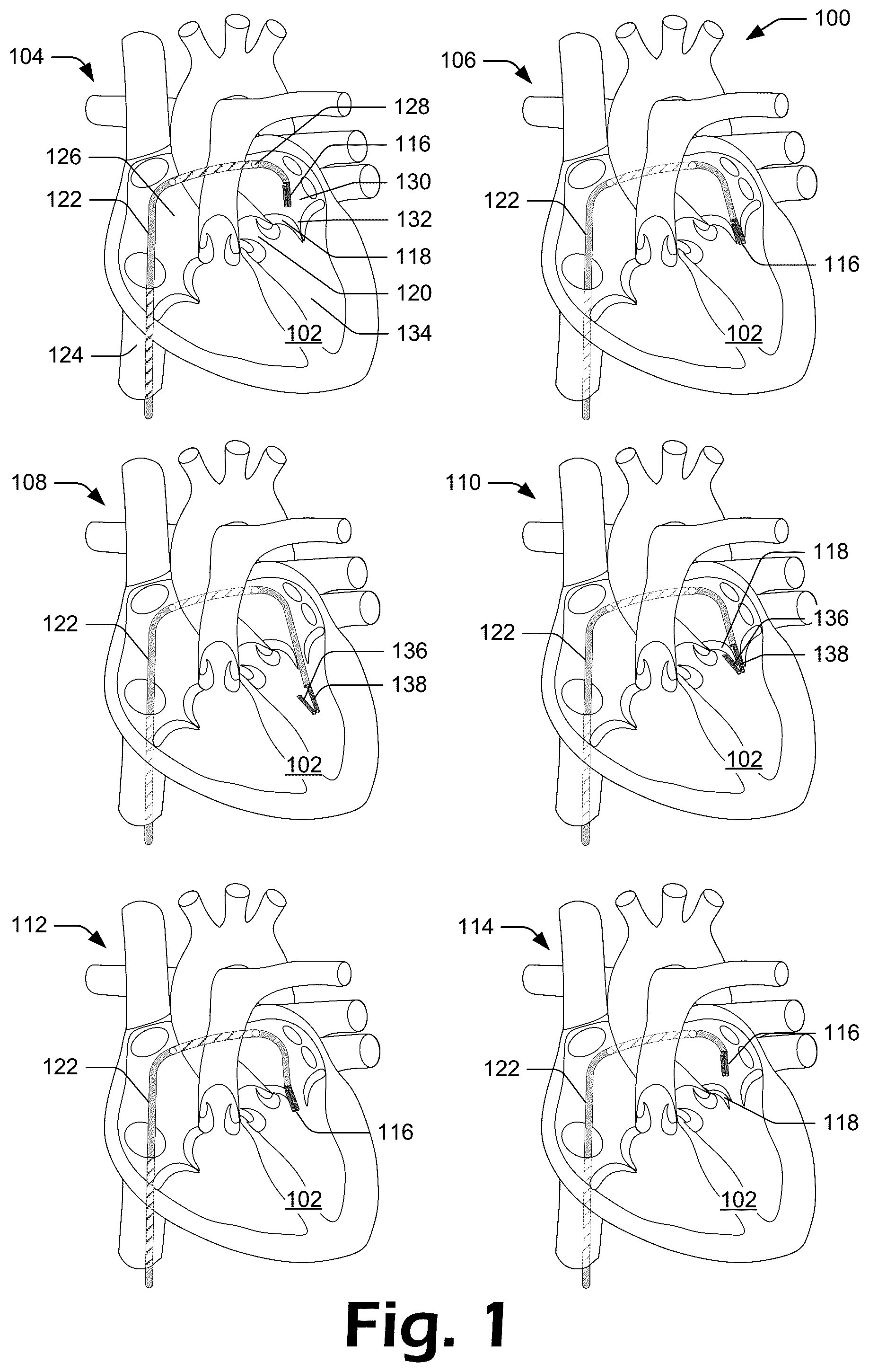 Patent US12137927 — Cutting grasper for valve leaflet laceration — Figure 1