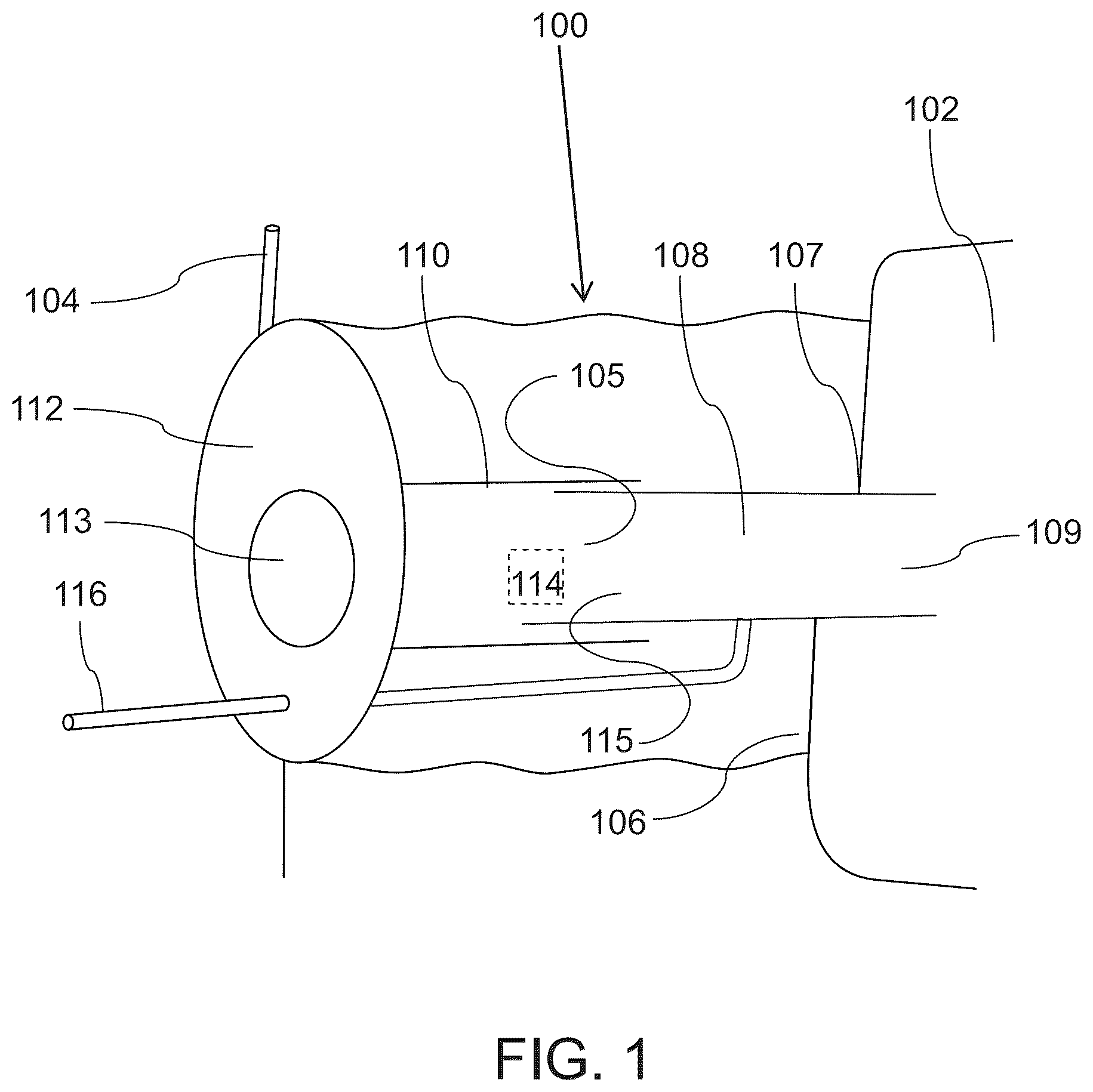 Patent US12137933 — Tools and methods for vaginal access — Figure 1