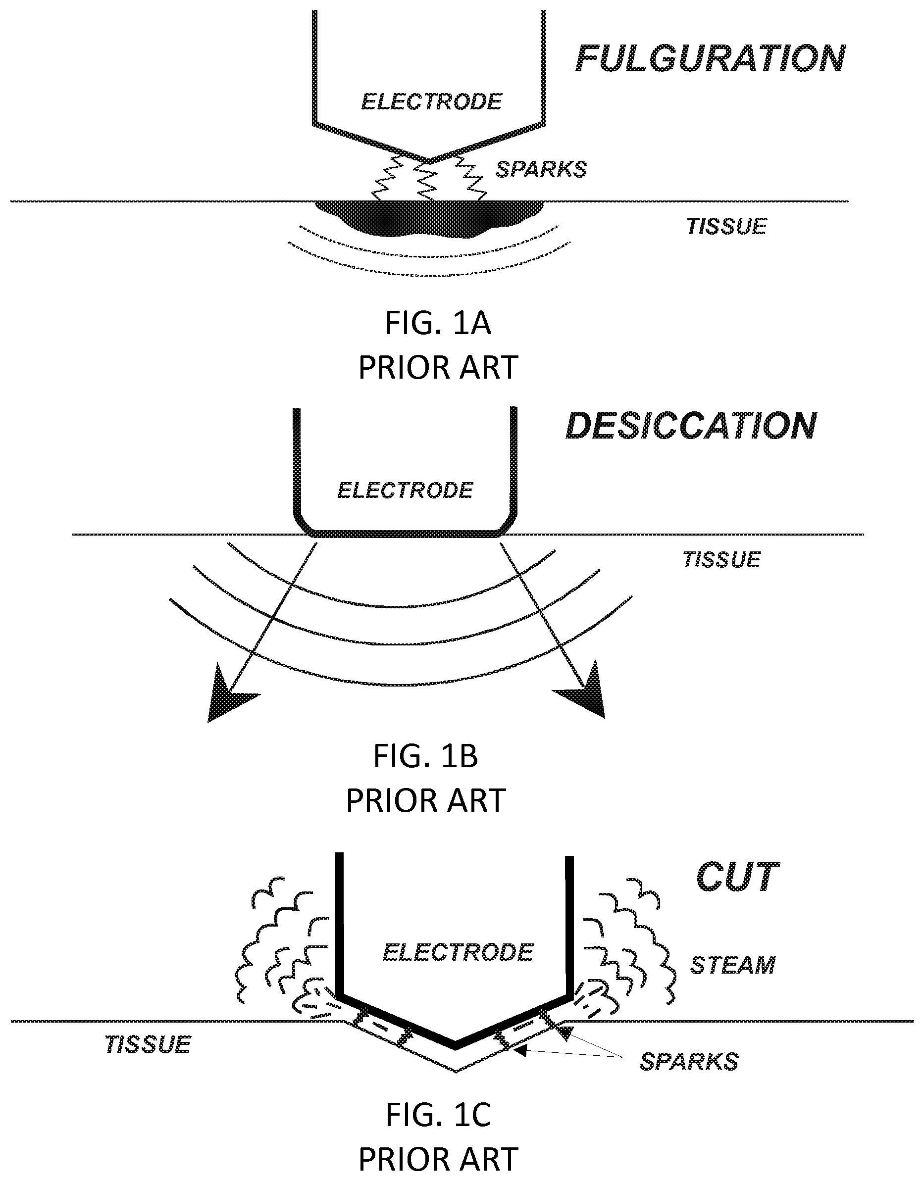 Patent US12137958 — System and method for electrosurgical conductive gas cutting for improving eschar, sealing vessels and tissues — Figure 1