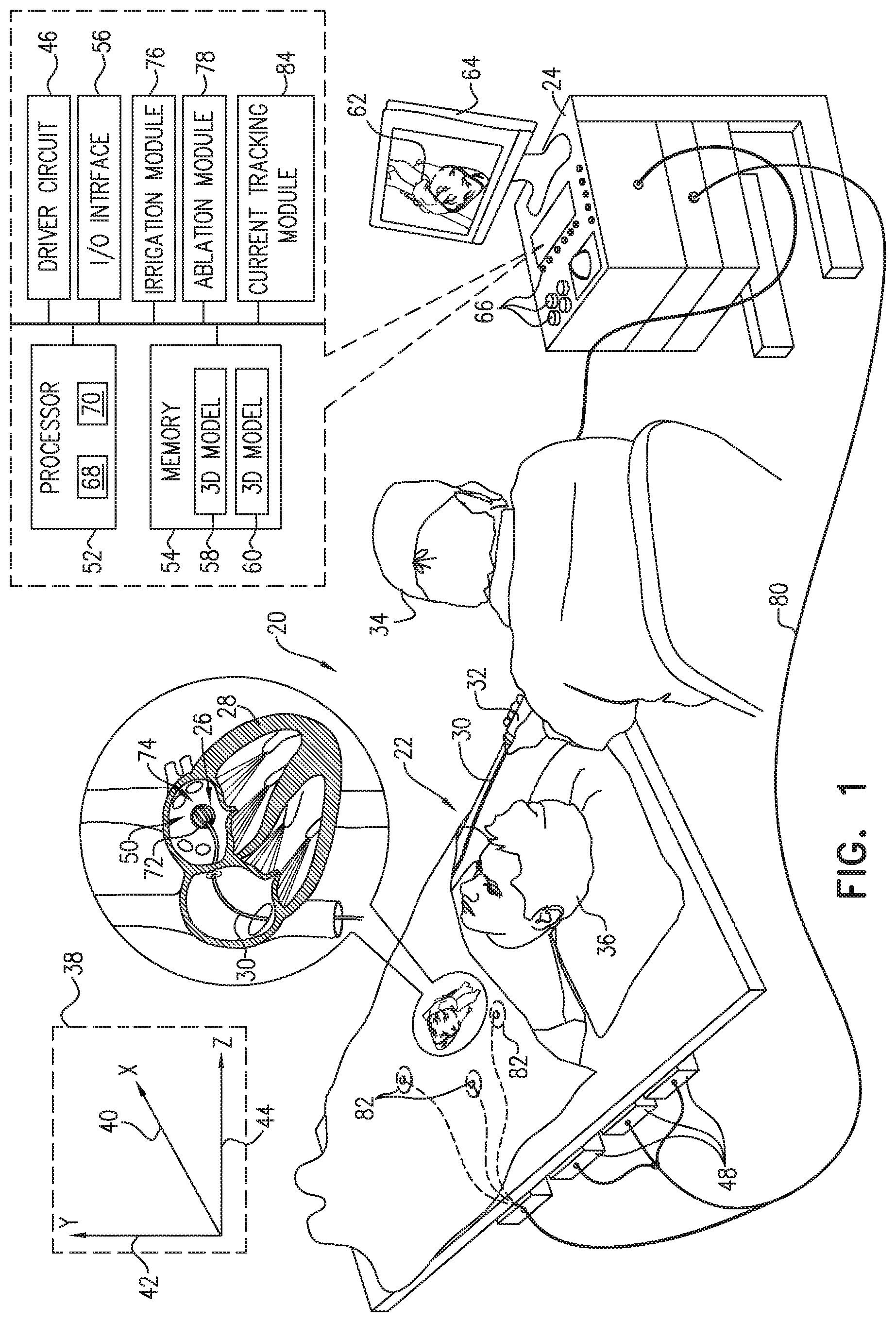 Patent US12137967 — Accurate positioning and shape visualization of balloon catheter ablation tags — Figure 1