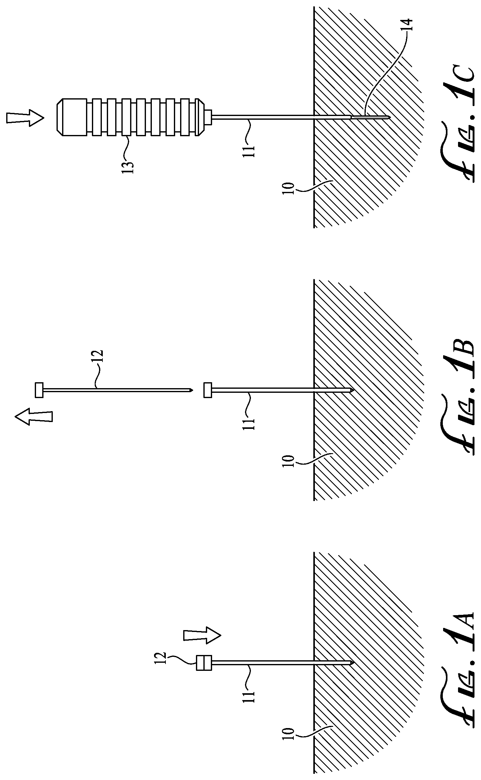 Patent US12137972 Figure 1 – Biopsy tract ablation system for tumor seeding prevention and cauterization