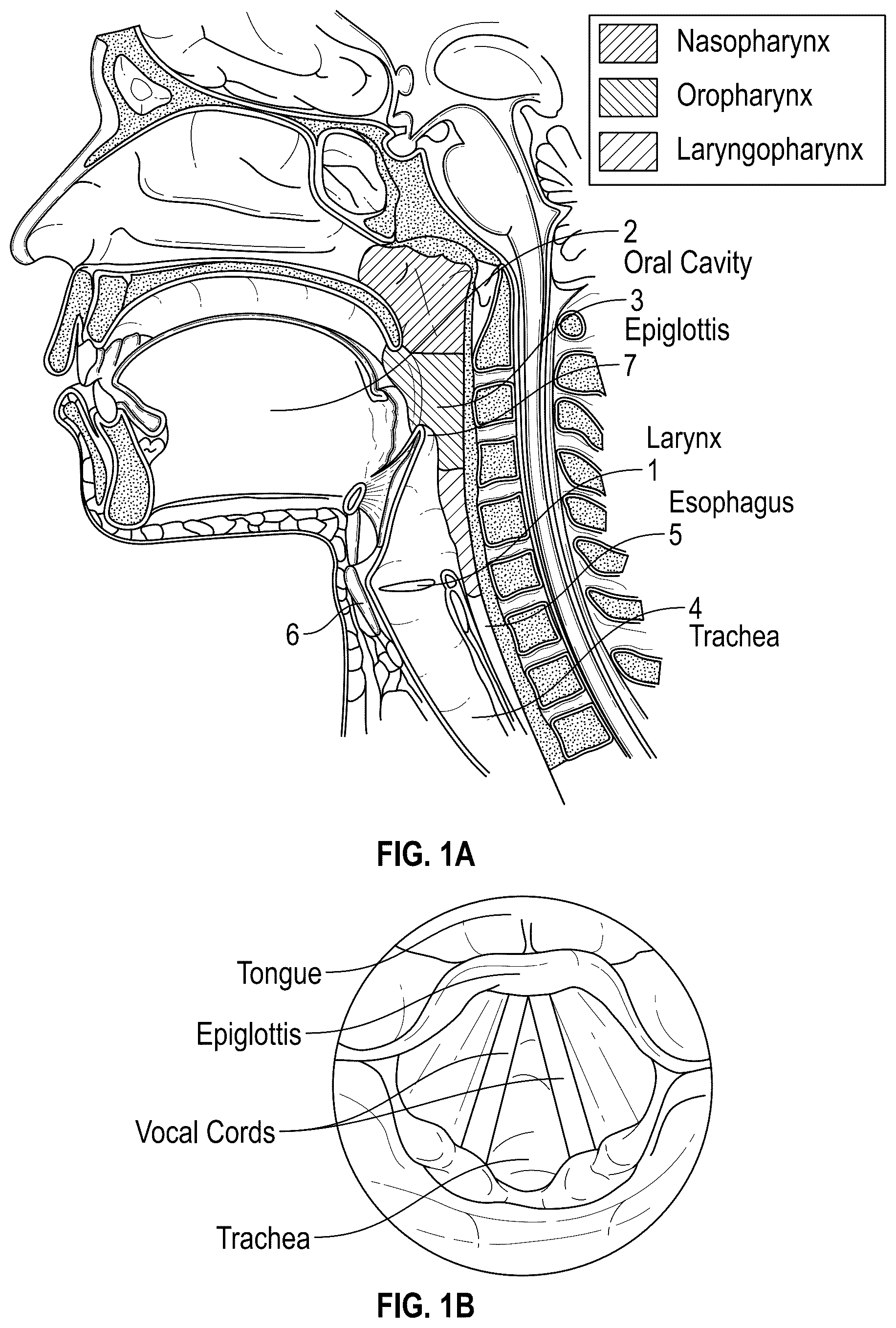 Patent US12137973 — Apparatus and techniques for surgical laser delivery — Figure 1