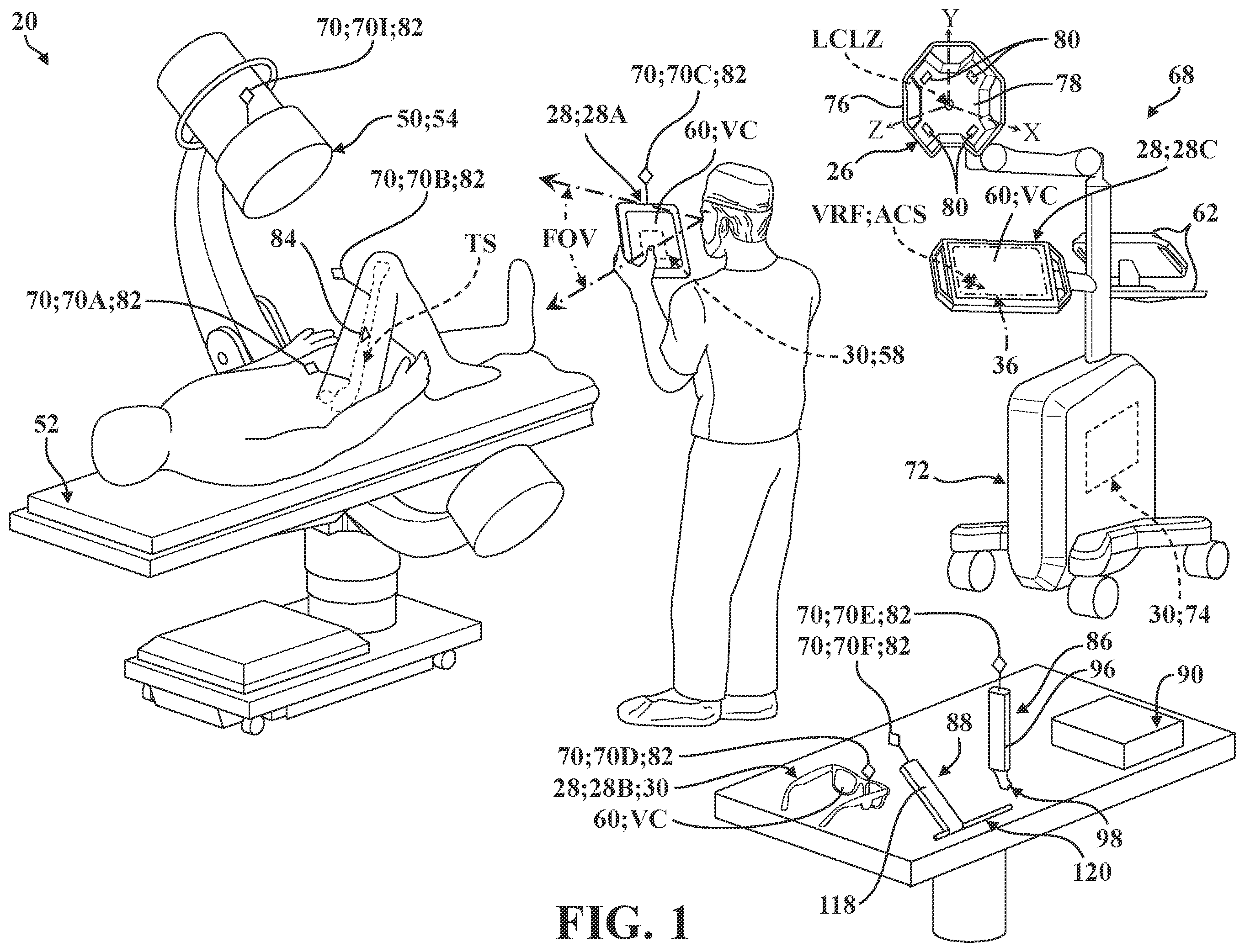Patent US12137981 — Surgical systems and methods for facilitating tissue treatment — Figure 1
