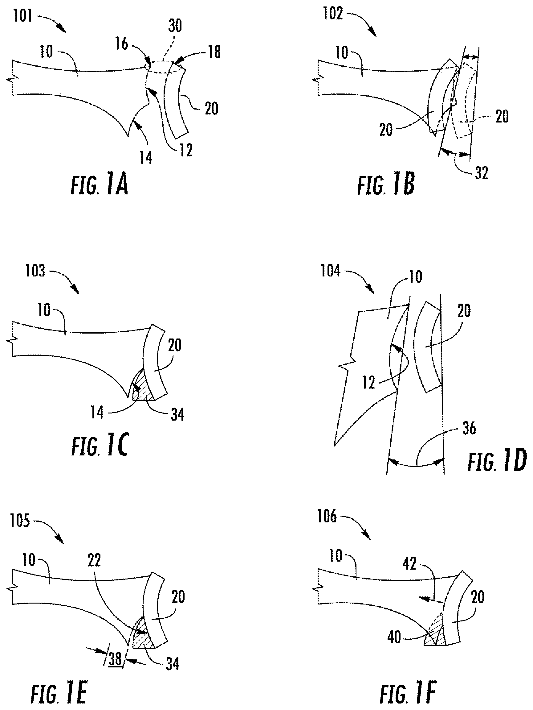 Patent US12137982 Figure 1 – Methods, systems and devices for pre-operatively planned shoulder surgery guides and implants