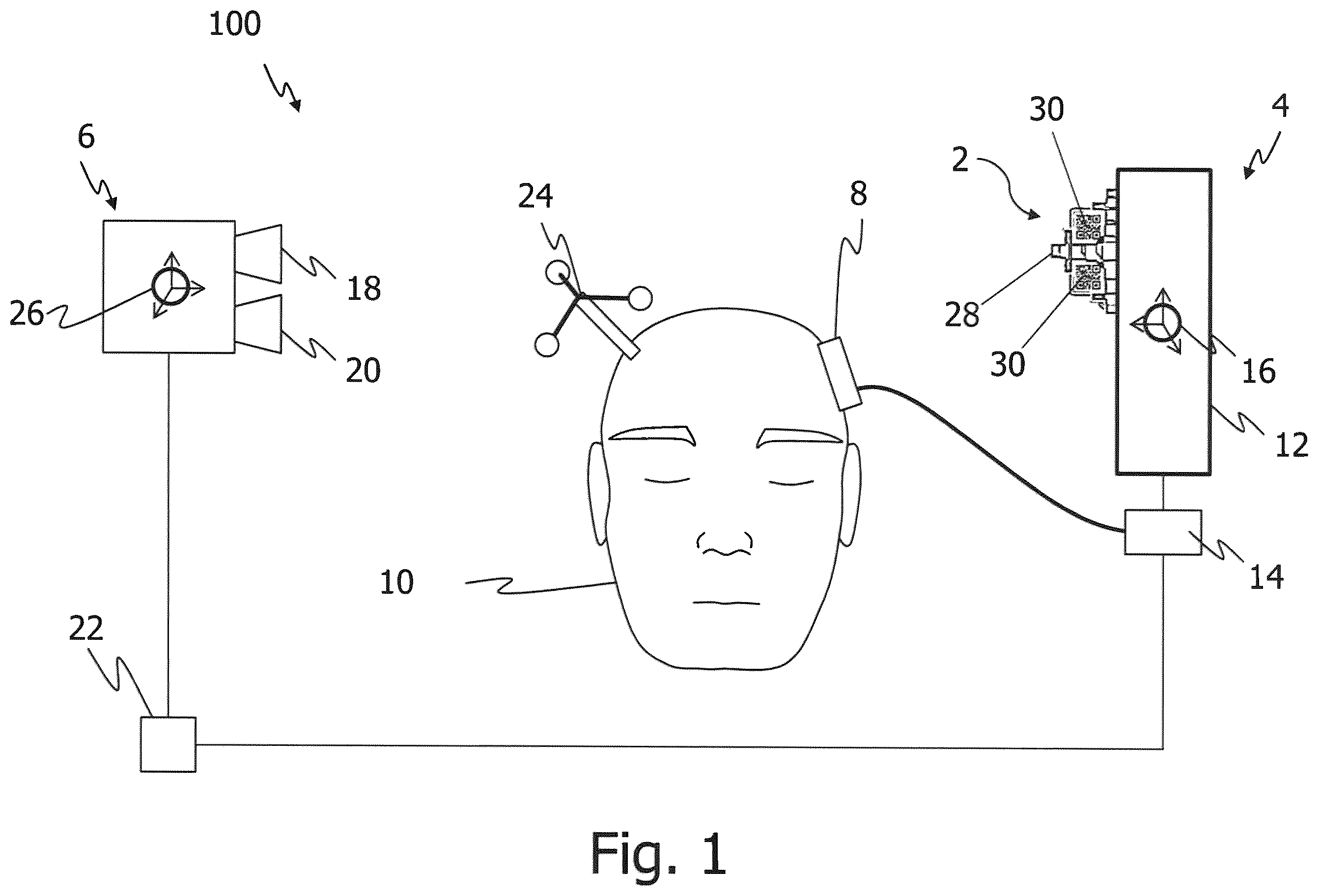 Patent US12137984 — Technique of determining a pose of a surgical registration device — Figure 1