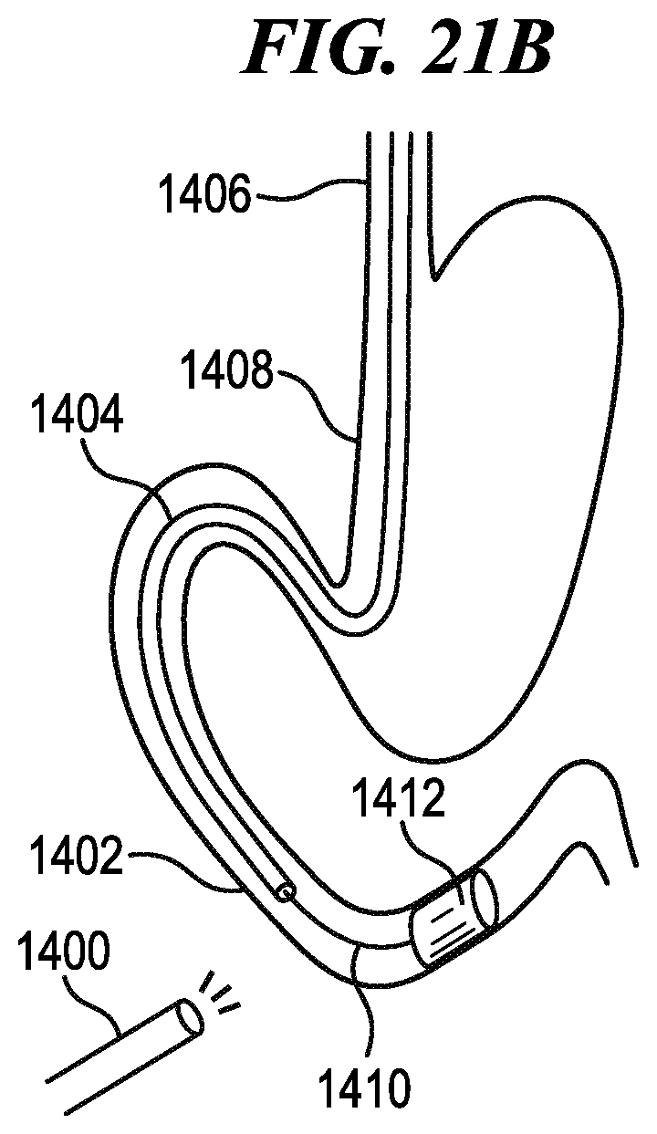 Patent US12137986 Figure 15 – Methods for controlling cooperative surgical instruments