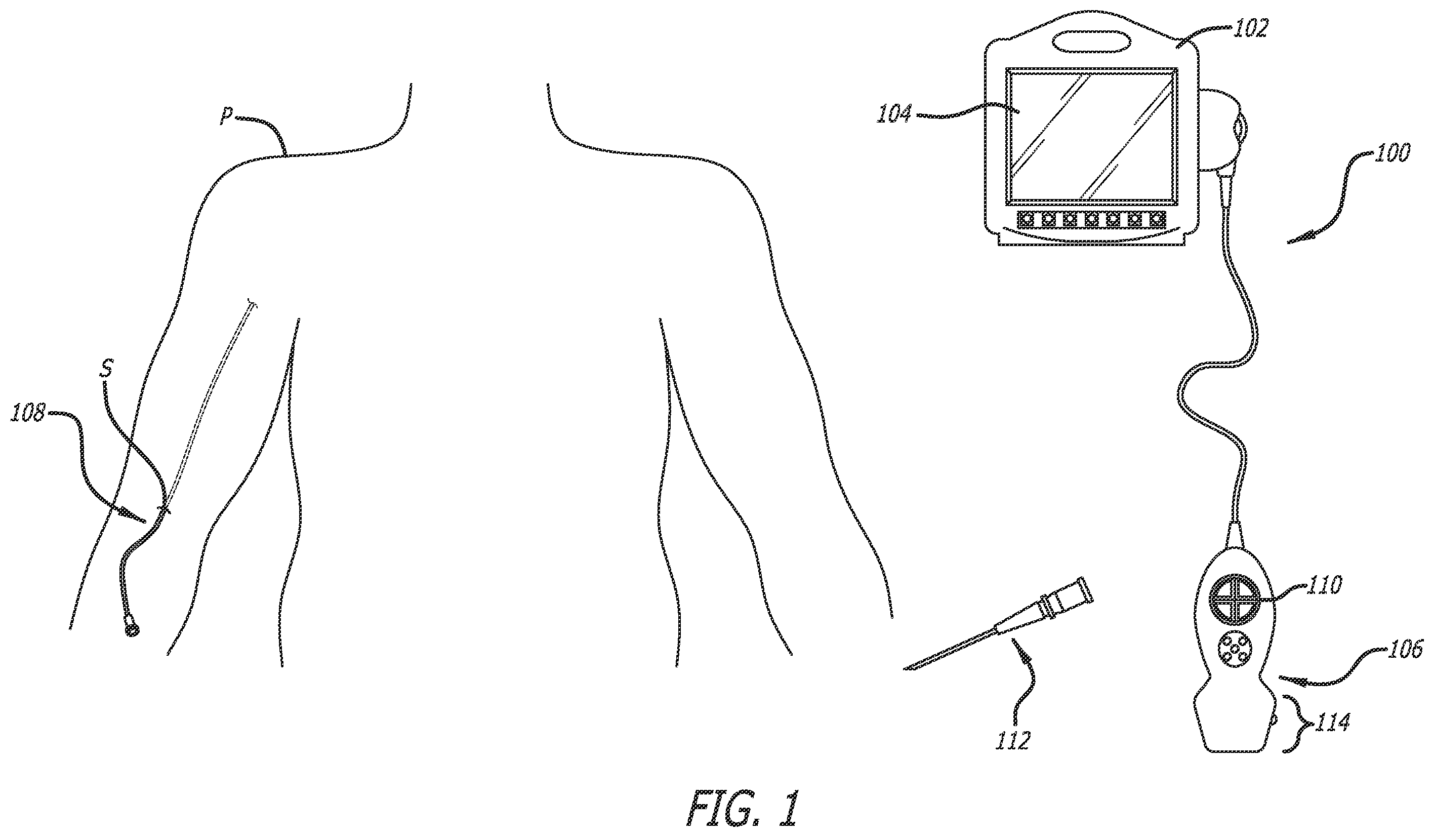 Patent US12137989 — Systems and methods for intelligent ultrasound probe guidance — Figure 1