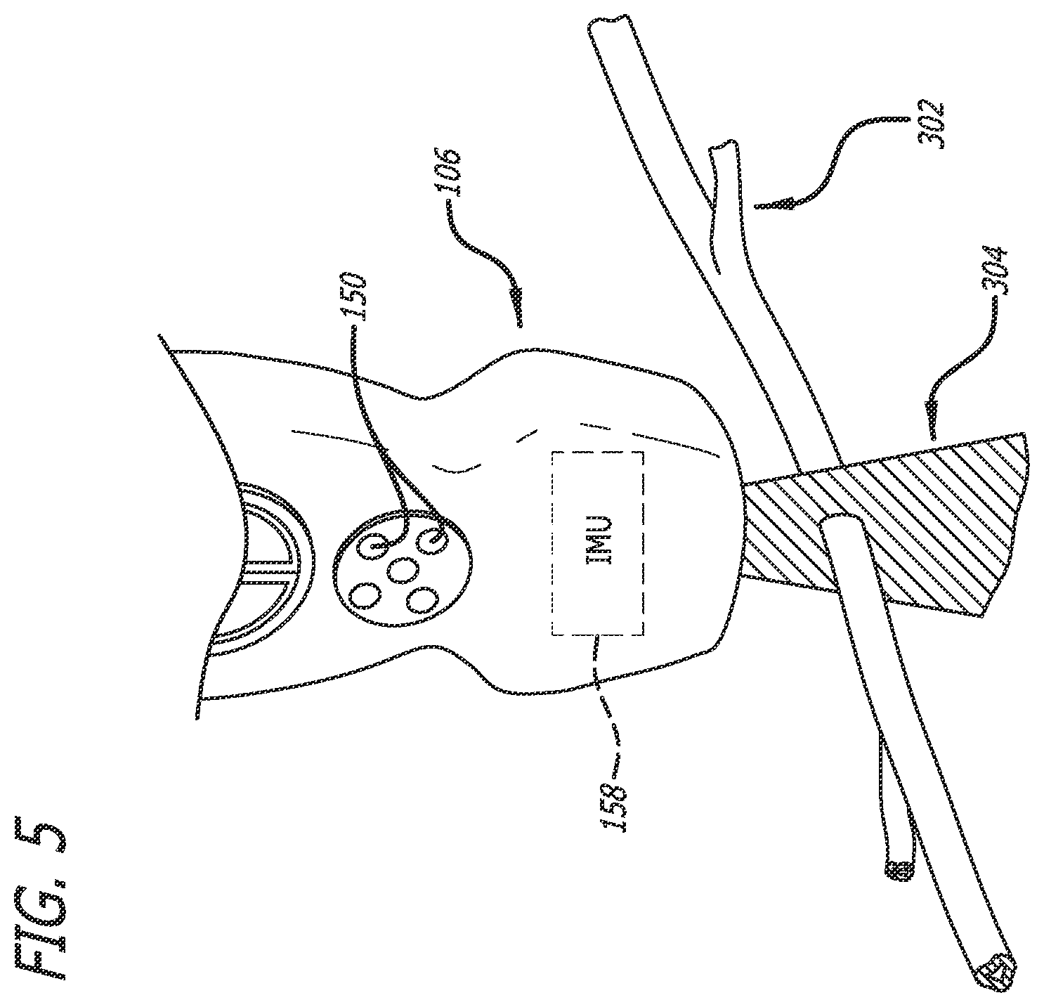 Patent US12137989 Figure 5 – Systems and methods for intelligent ultrasound probe guidance