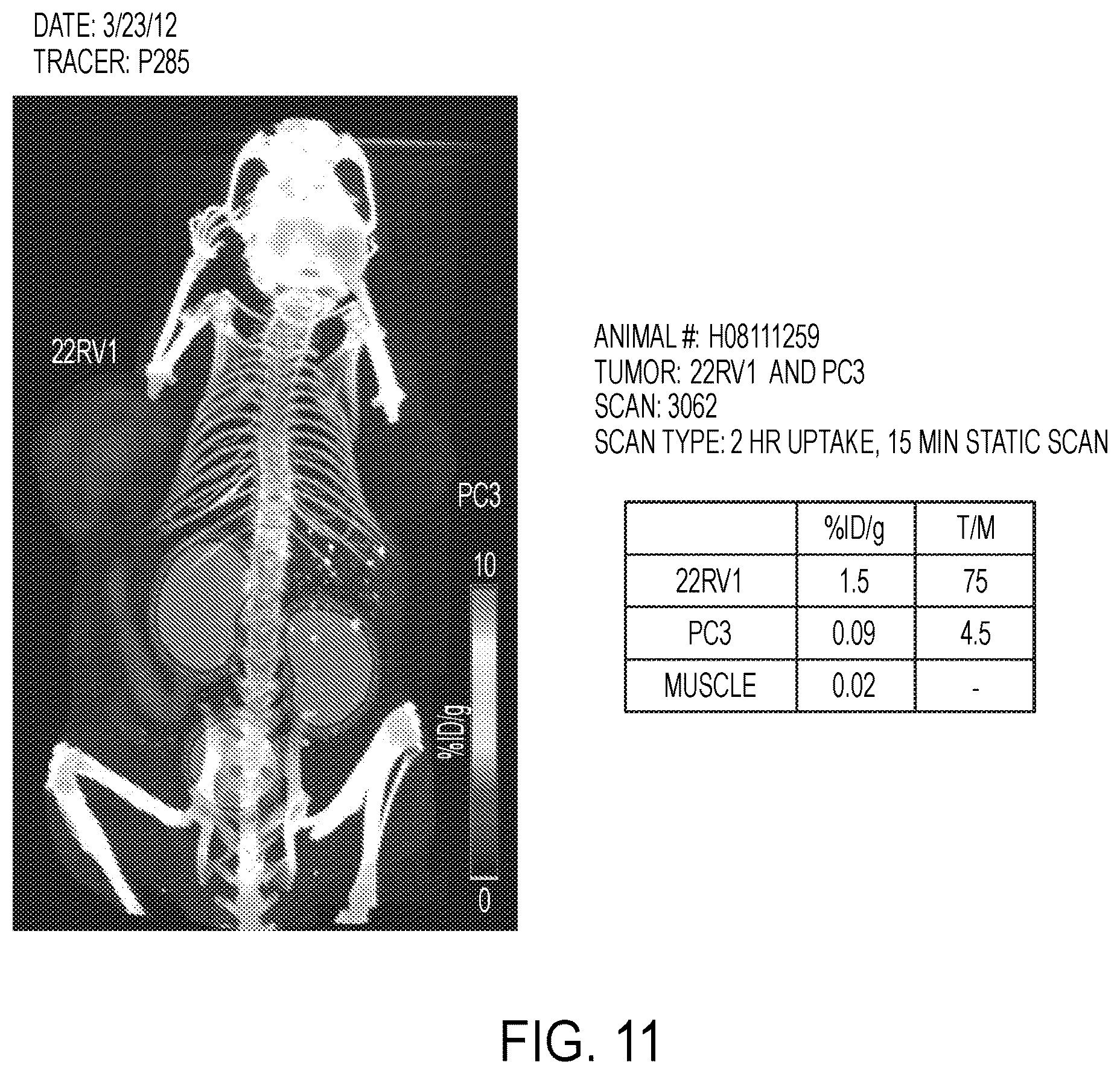 Patent US12139554 Figure 11 – PSMA imaging agents