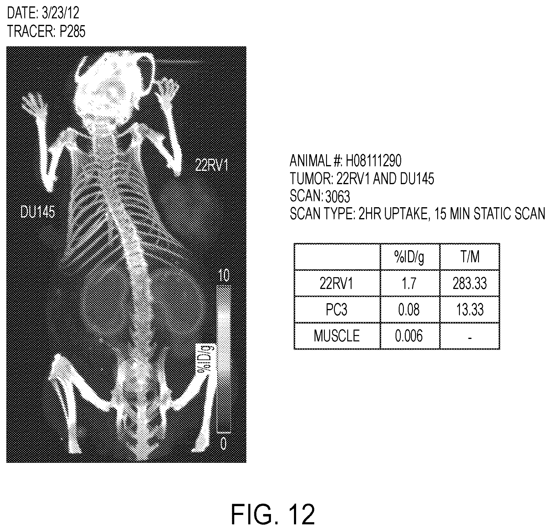 Patent US12139554 Figure 12 – PSMA imaging agents