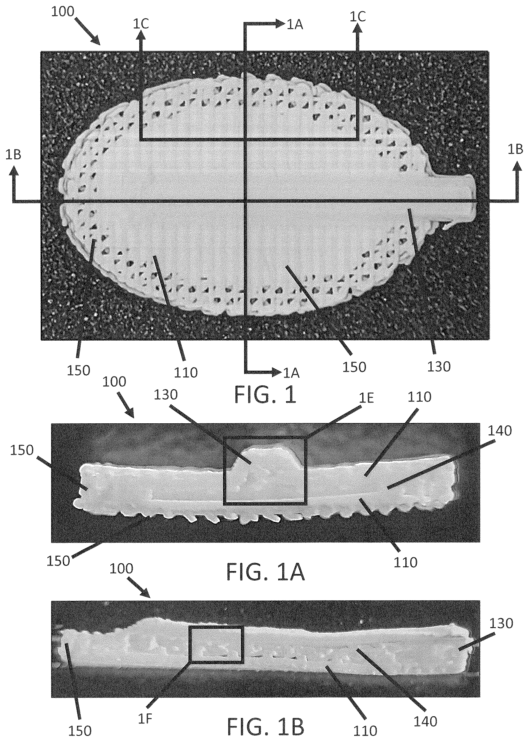 Patent US12139696 — Biointegrative implantable cell encapsulation device and system — Figure 1