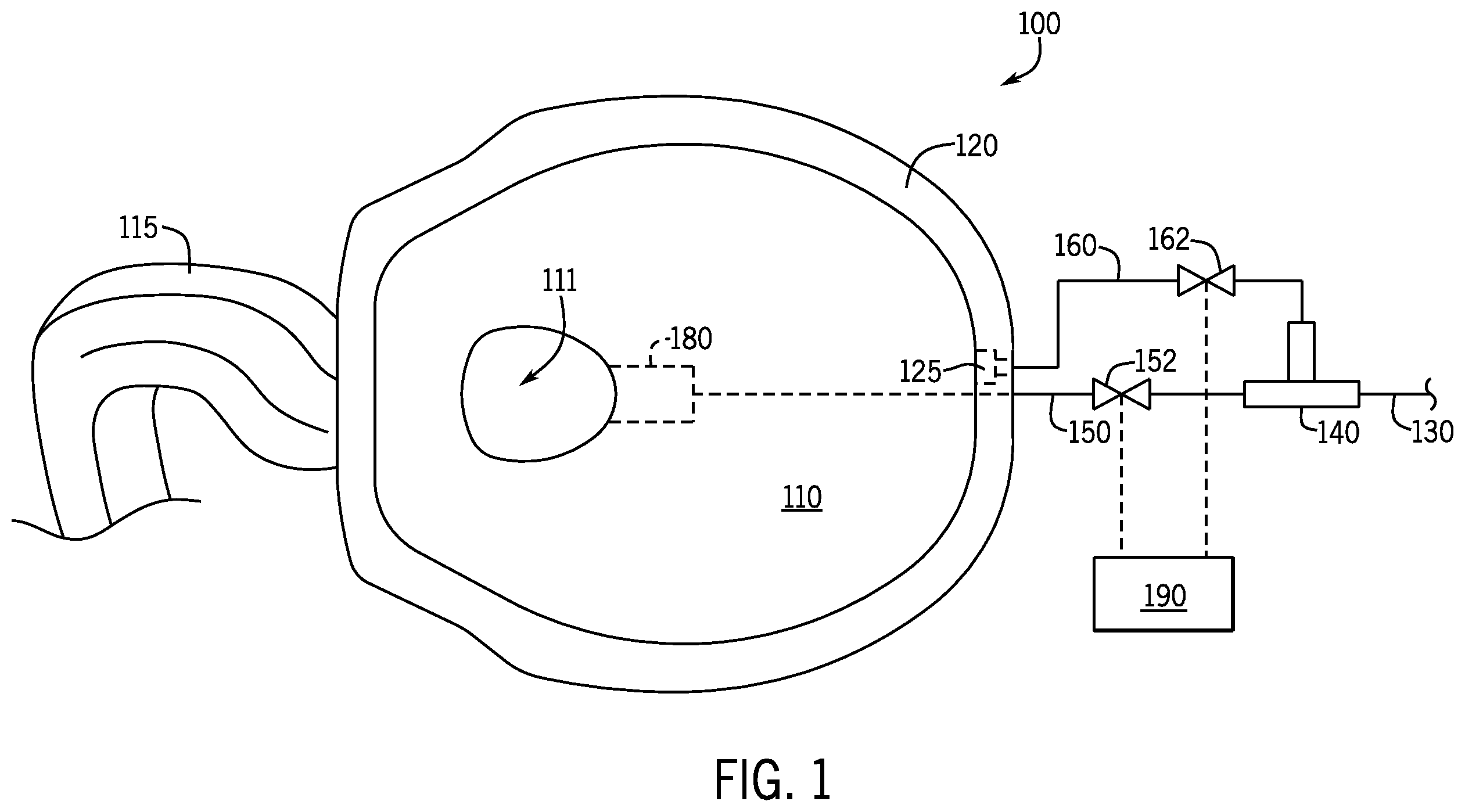 Patent US12139899 Figure 1 – Line pressure-driven, tankless, siphonic toilet