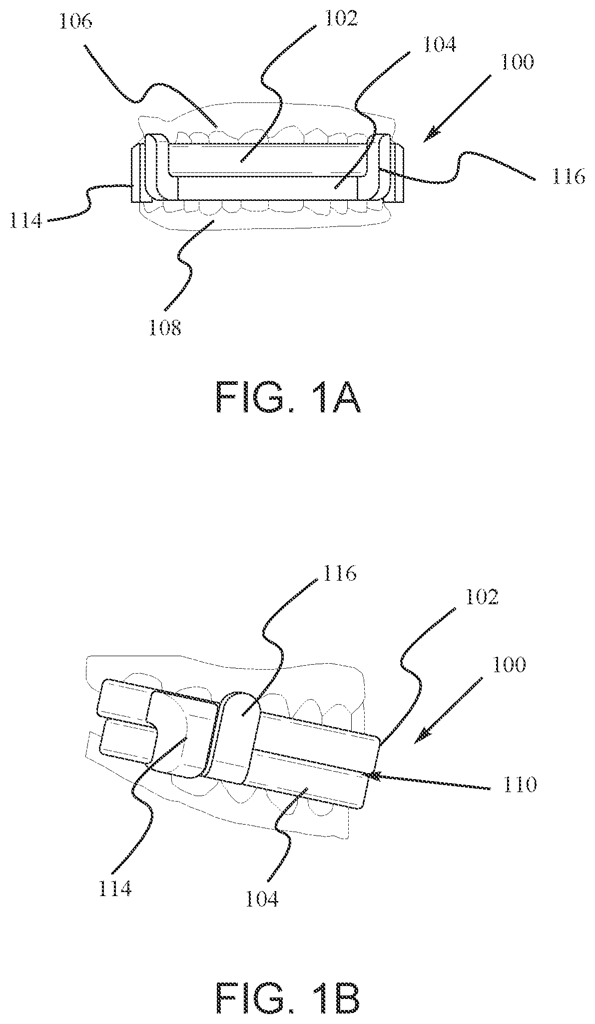 Patent US12147214 — Computer aided design matrix for the manufacture of dental devices — Figure 1