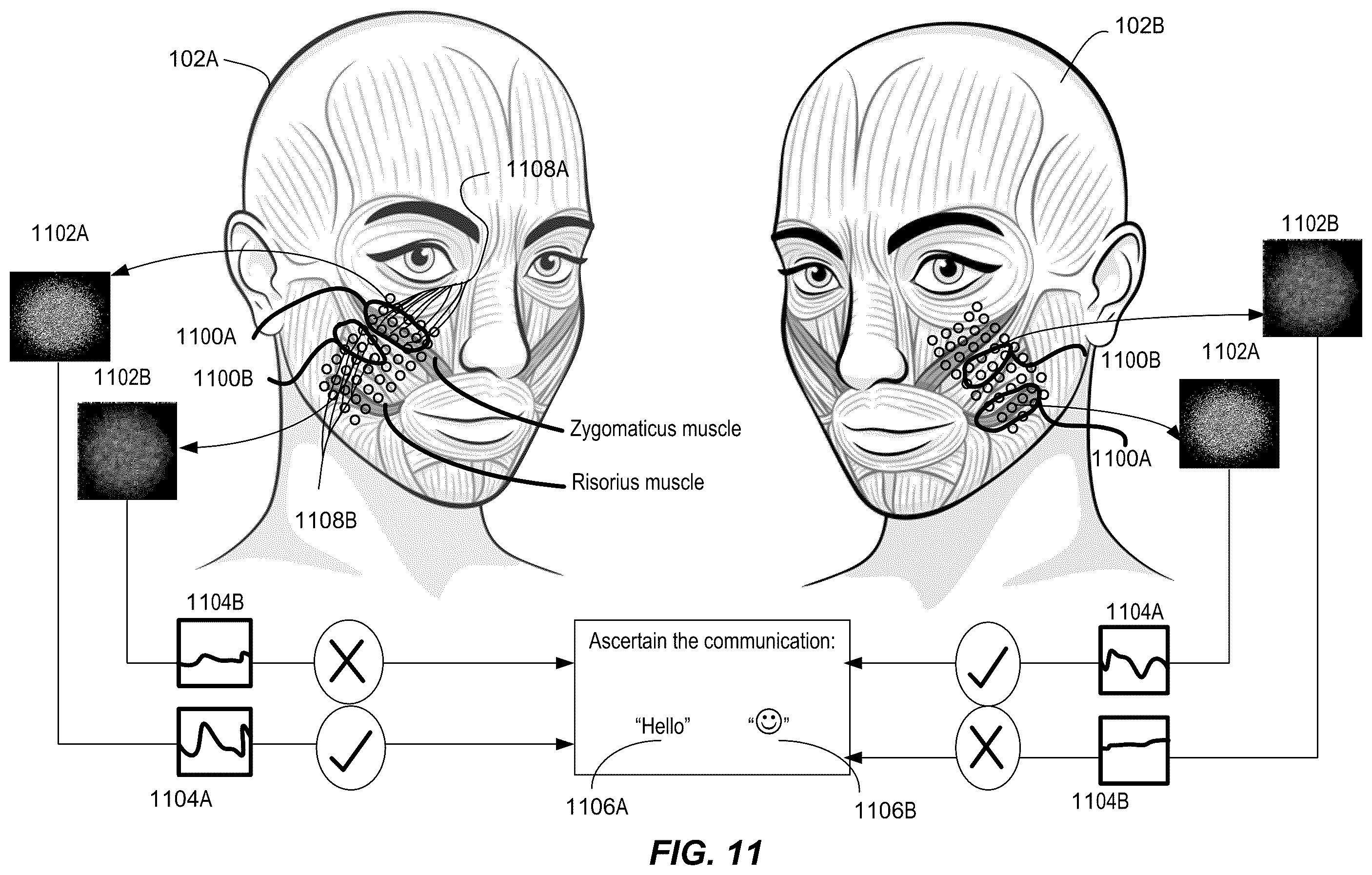 Patent US12147521 Figure 12 – Threshold facial micromovement intensity triggers interpretation