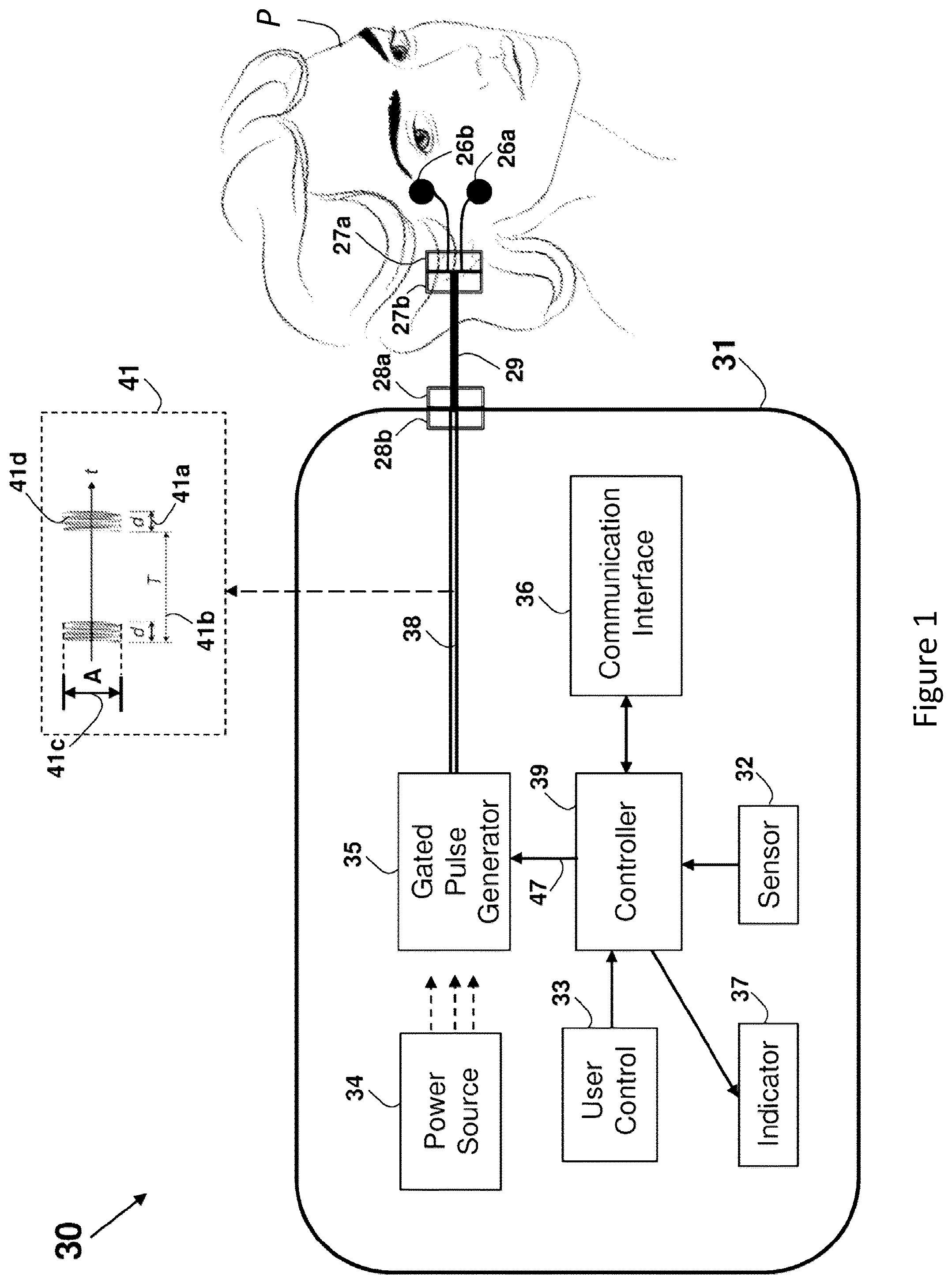 Patent US12157002 Figure 1 – Wearable electrode device having magnetic connectors