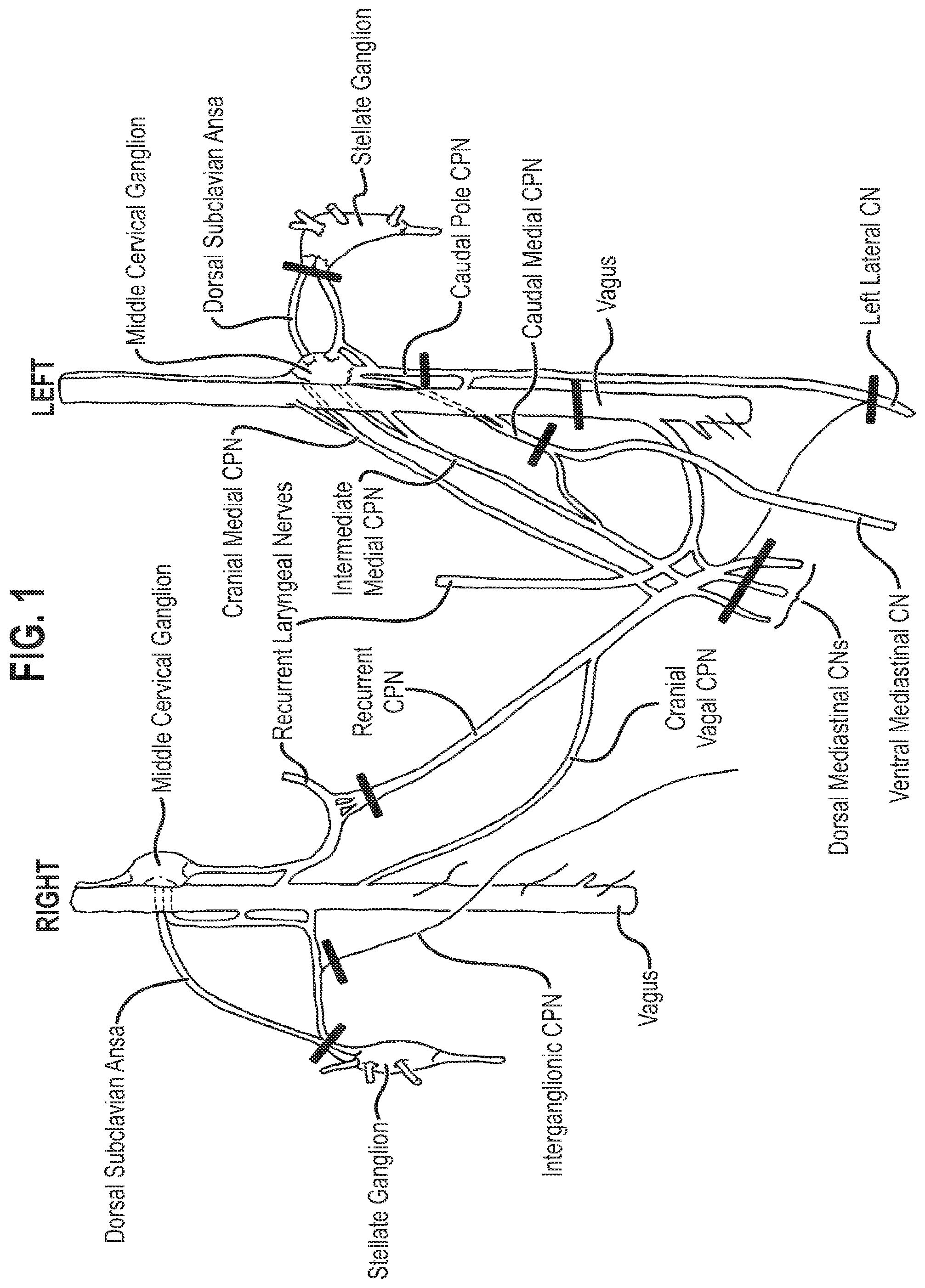 Patent US12157007 — Neuromodulation of ganglia — Figure 1