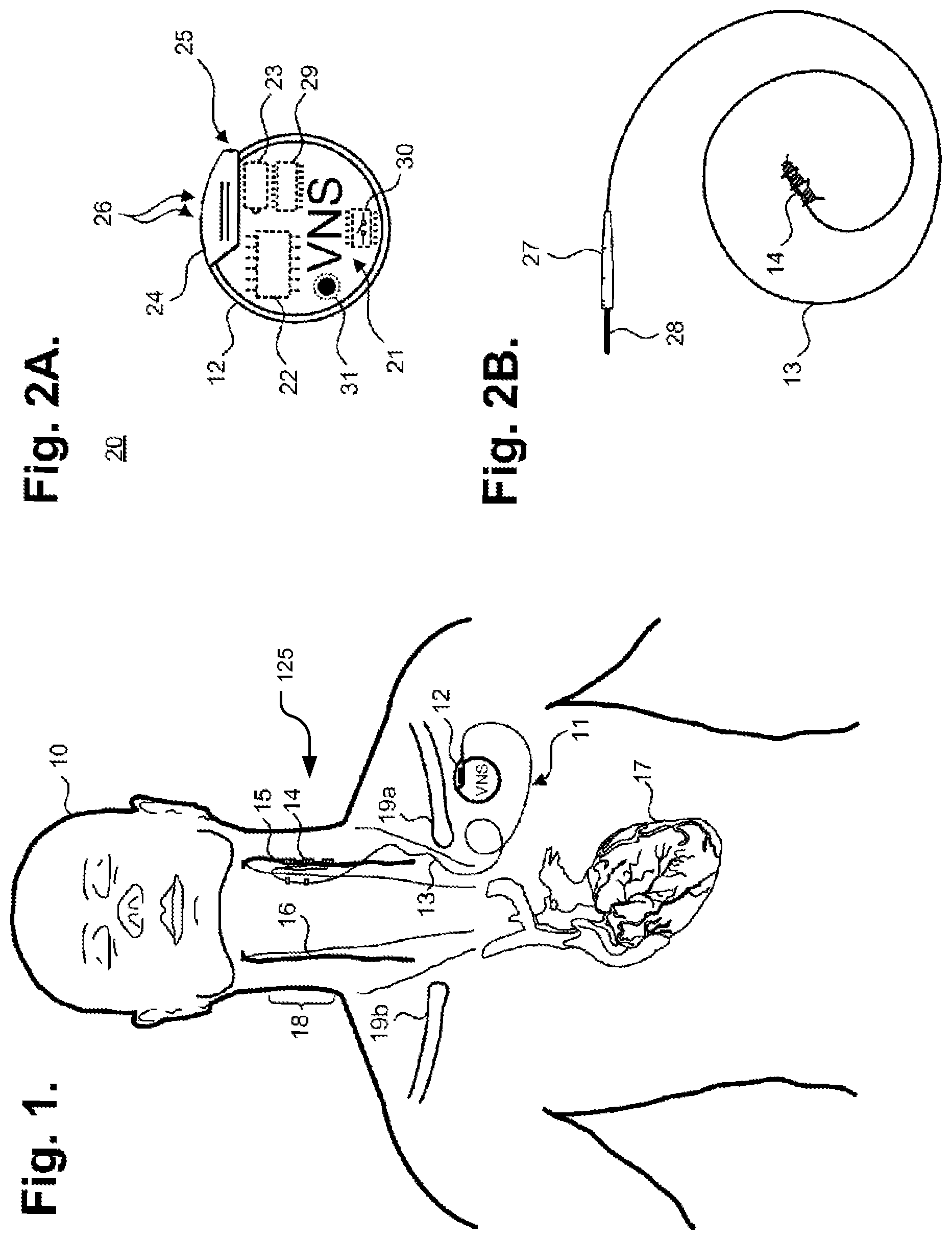 Patent US12157008 — Responsive neurostimulation for the treatment of chronic cardiac dysfunction — Figure 1