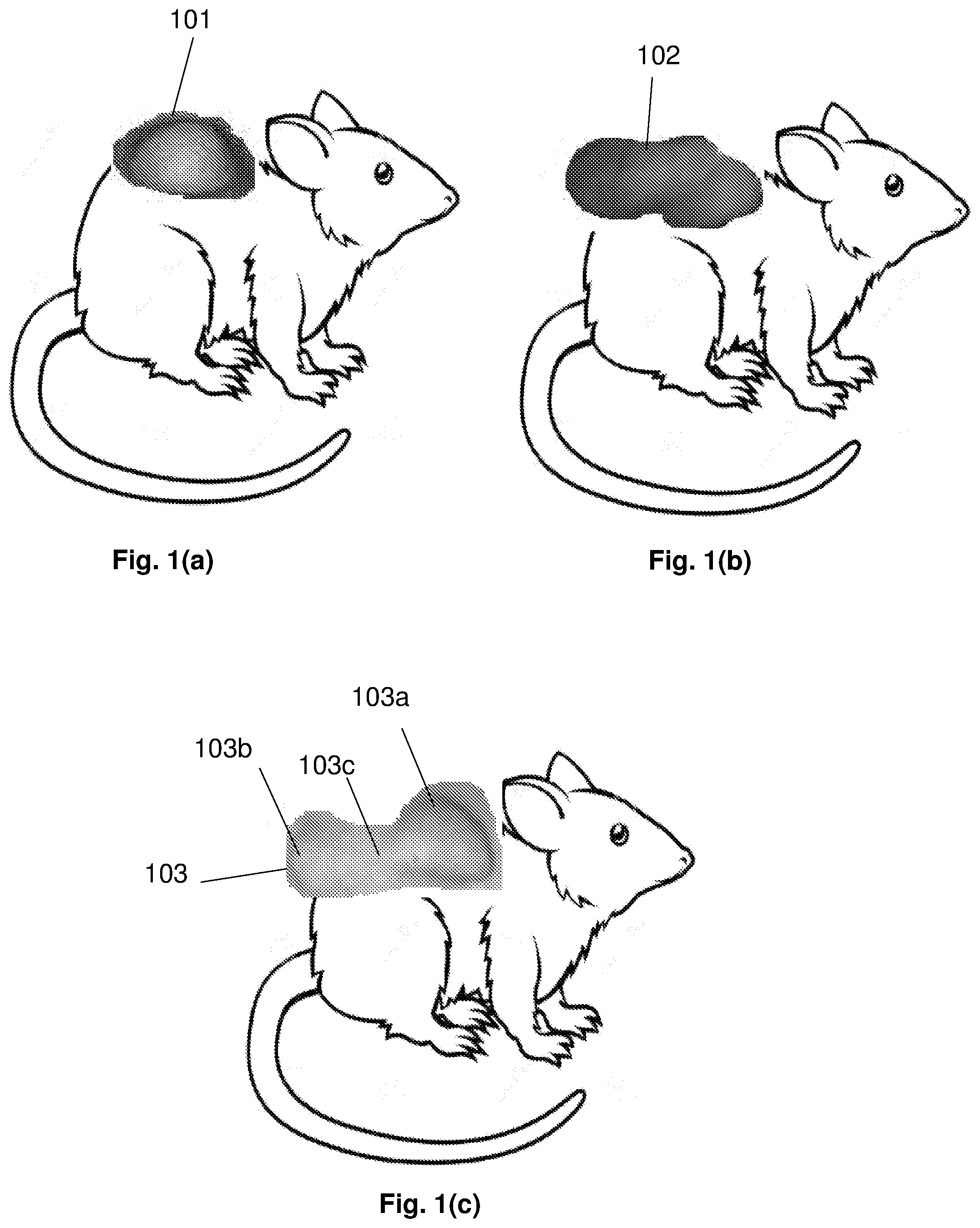 Patent US12165309 — Deformity edge detection — Figure 1