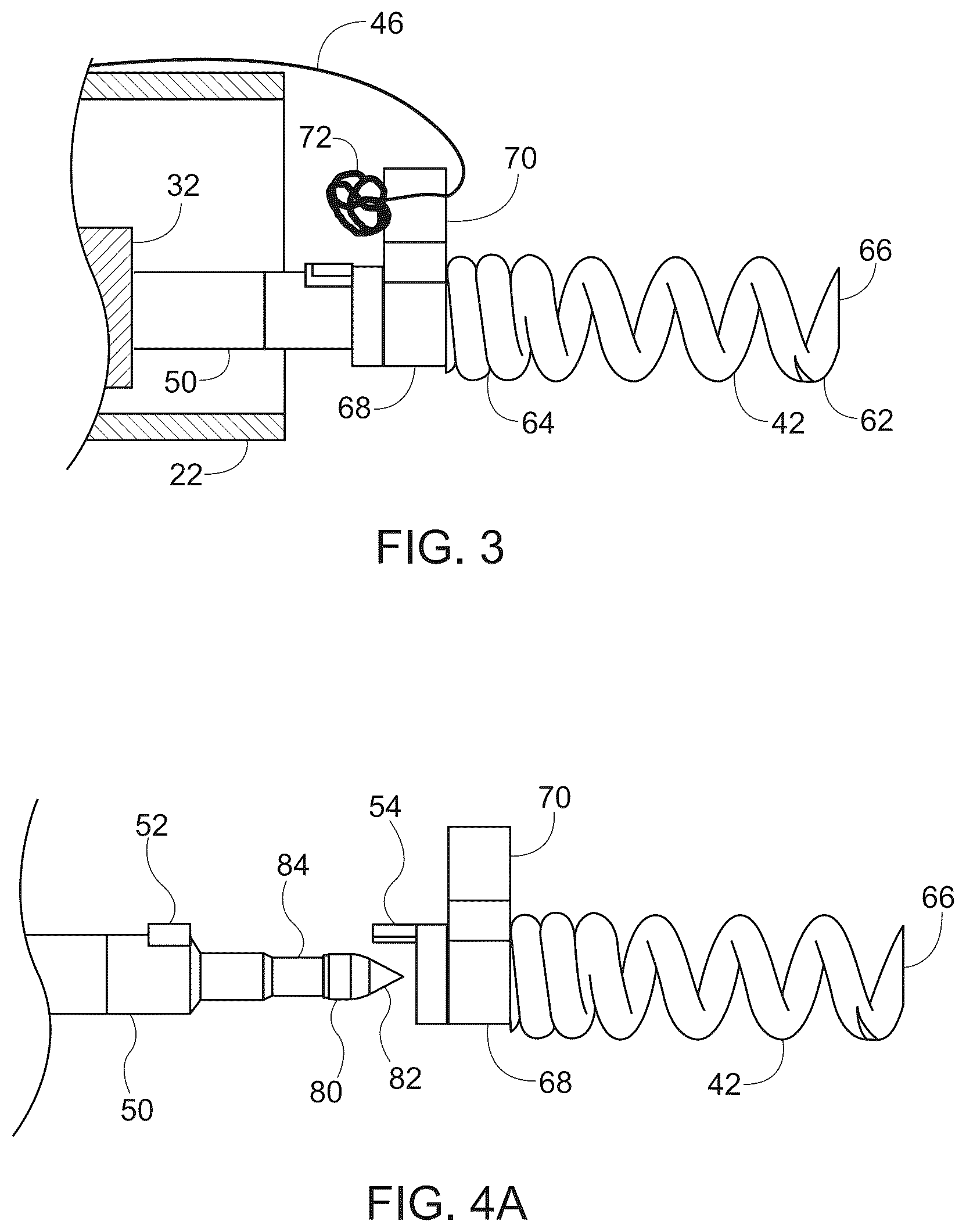 Patent US12167844 Figure 2 – Endoscopic tissue approximation system and methods