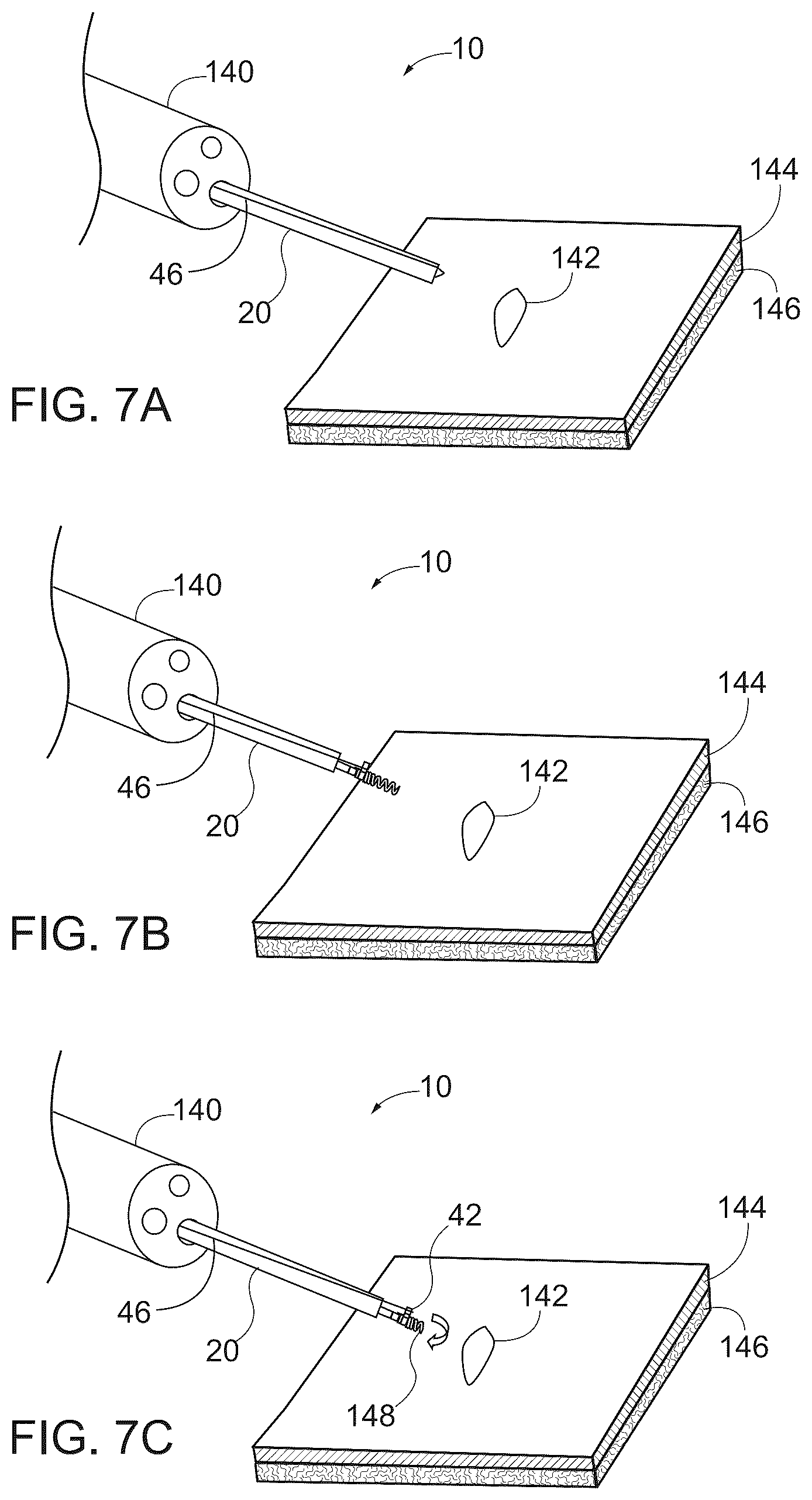 Patent US12167844 Figure 6 – Endoscopic tissue approximation system and methods