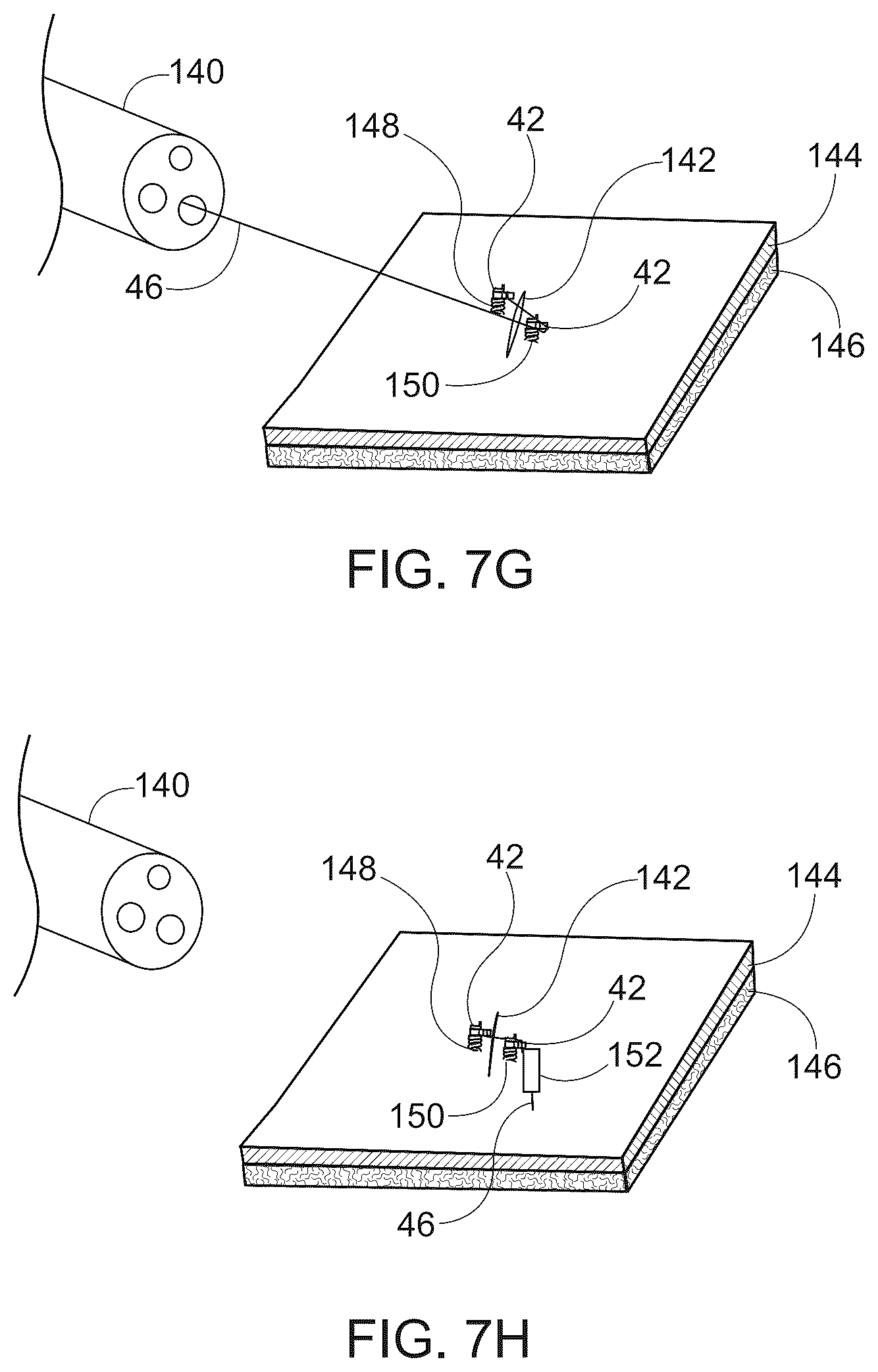 Patent US12167844 Figure 8 – Endoscopic tissue approximation system and methods