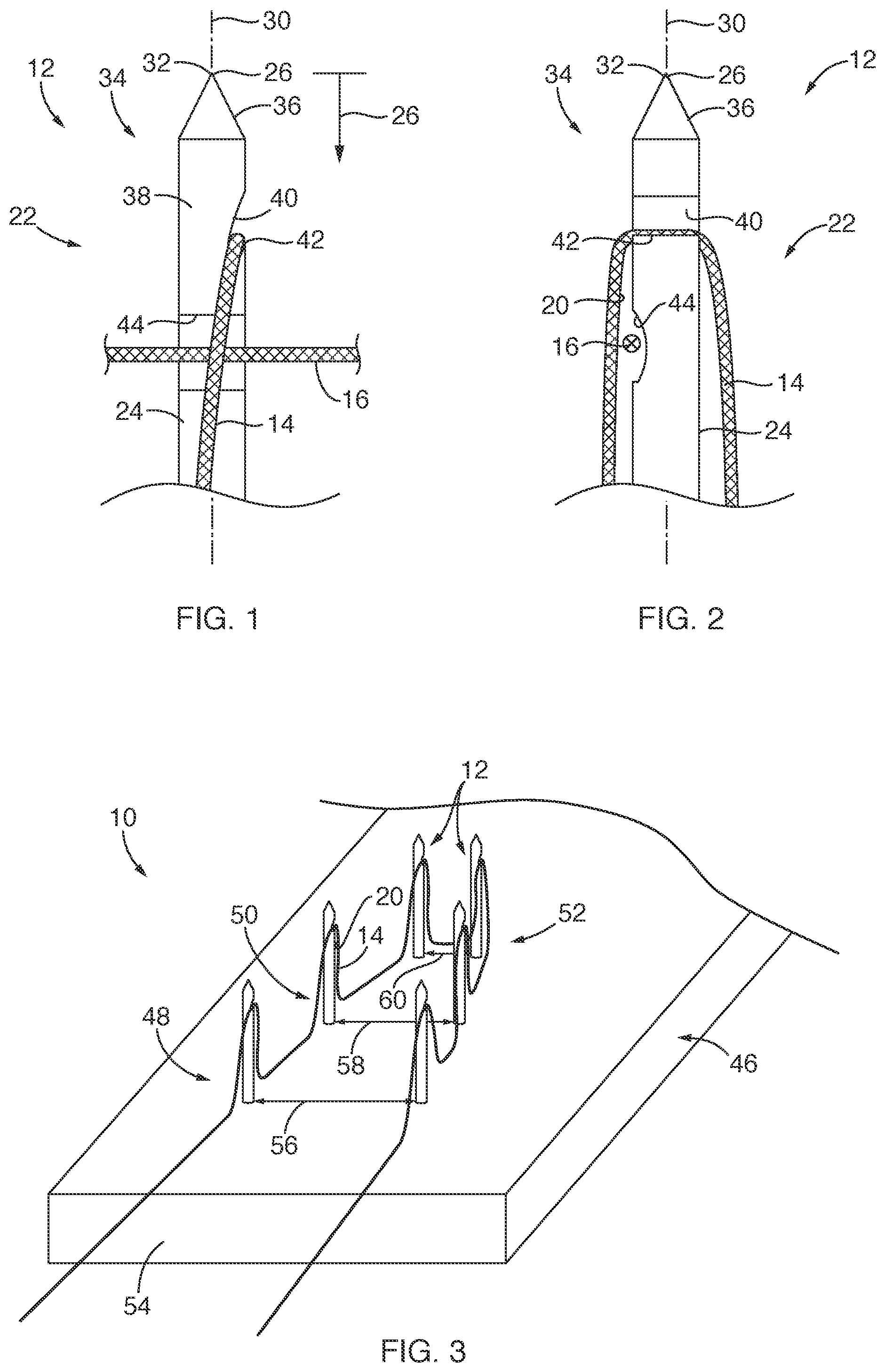 Patent US12167847 — Devices, systems, and methods for coupling flexible filament to soft tissue — Figure 1