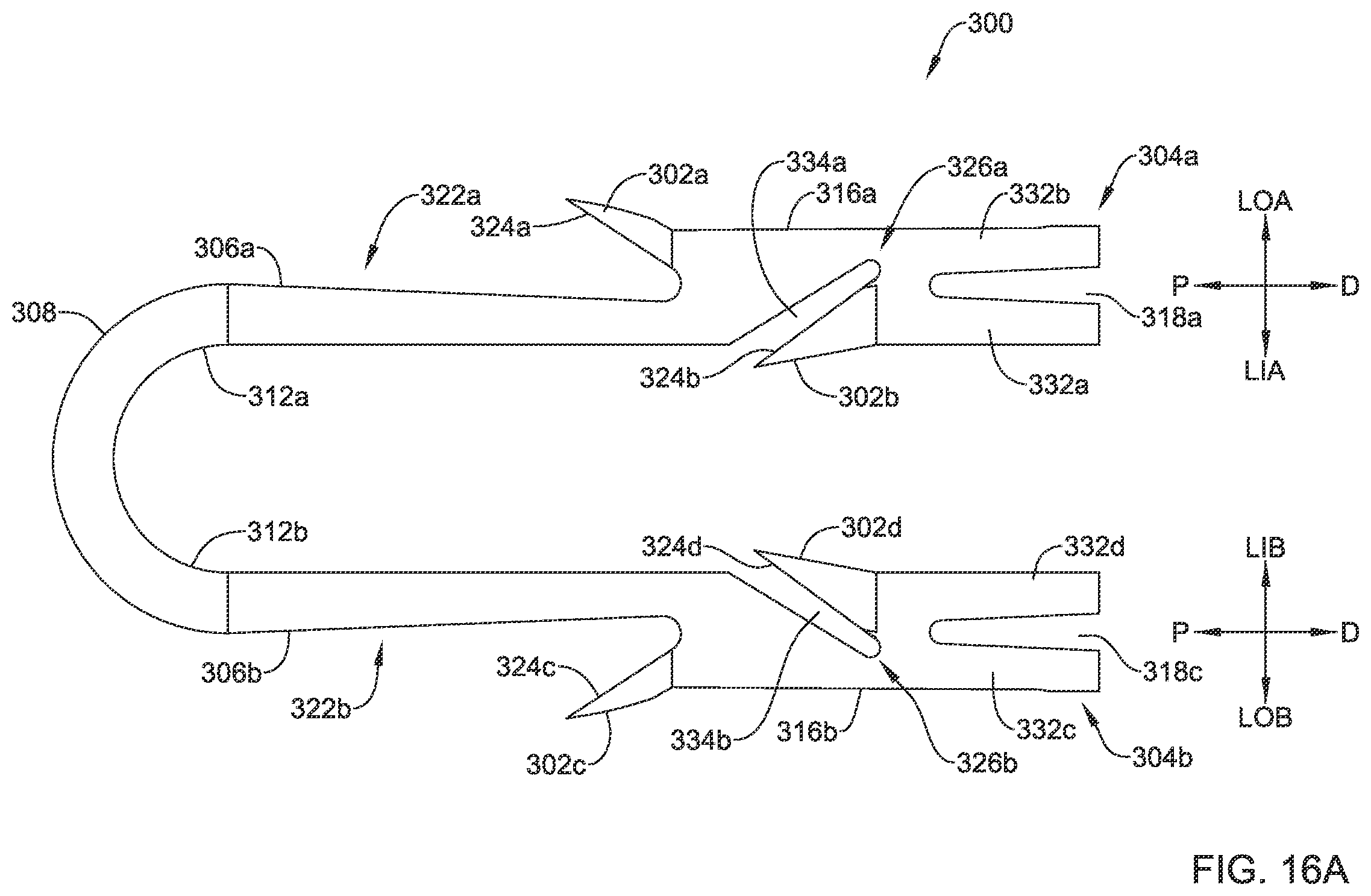 Patent US12167848 Figure 15 – Bone anchor delivery system