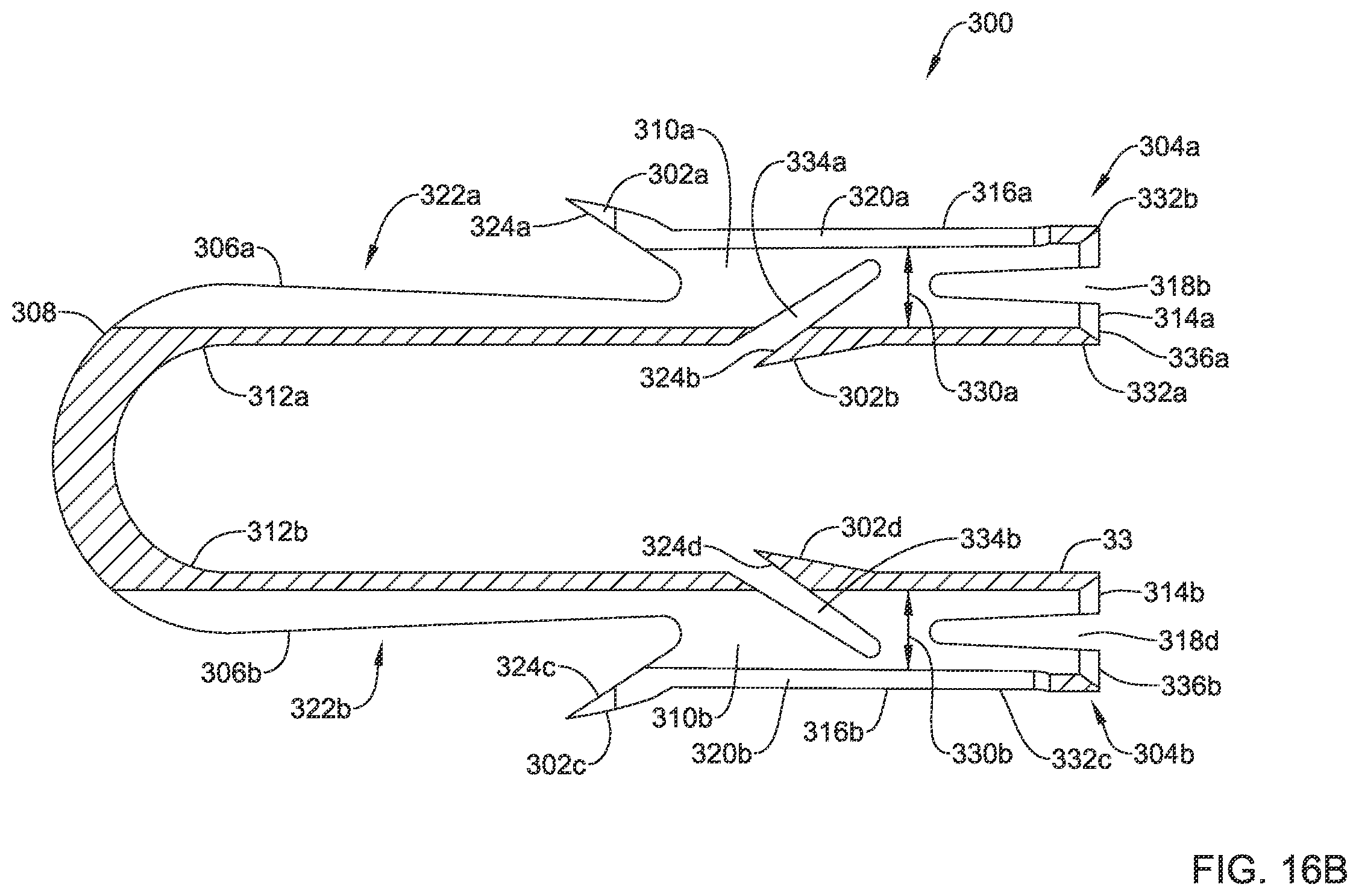 Patent US12167848 Figure 16 – Bone anchor delivery system