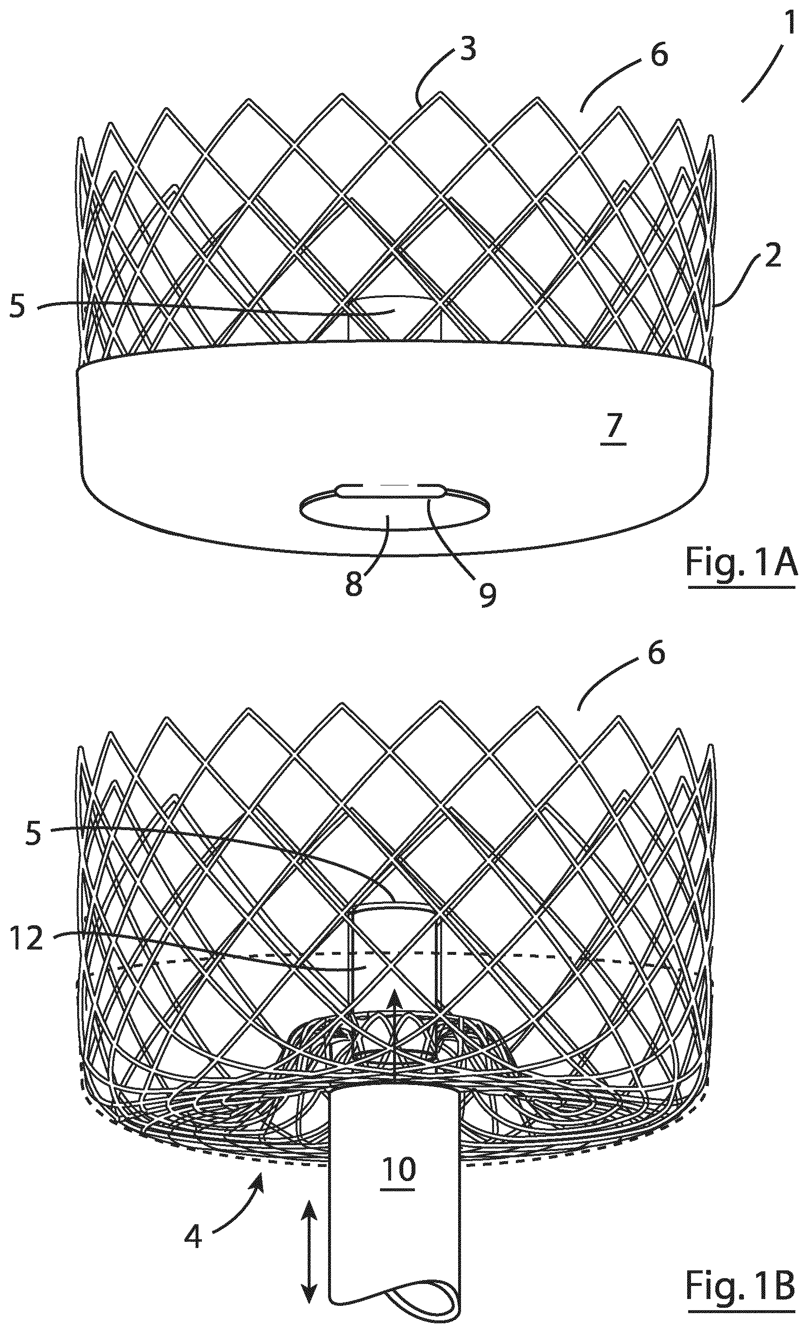 Patent US12167855 Figure 1 – Device for implantation in a left atrial appendage of the heart