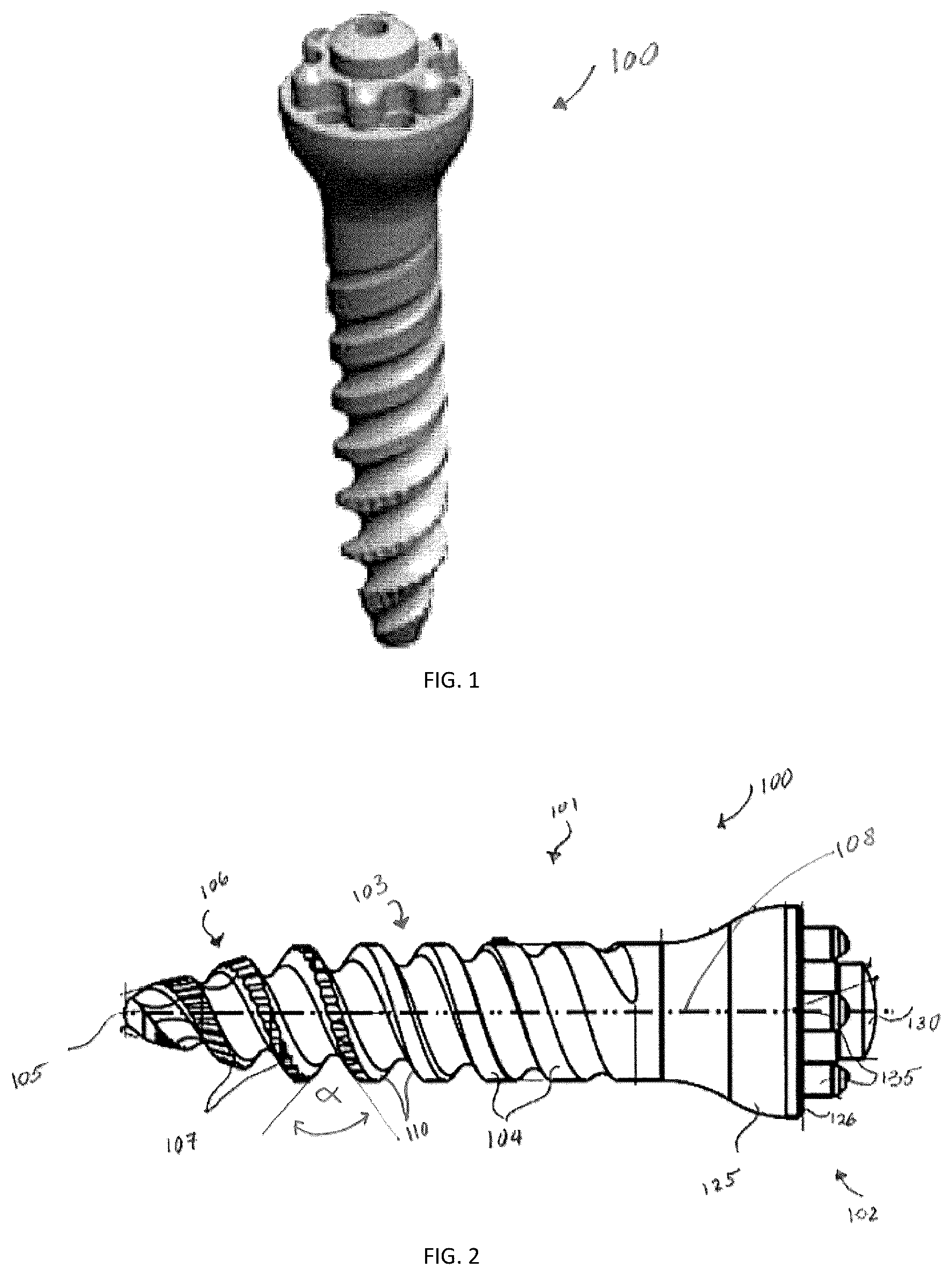 Patent US12167871 — Spinal fastener with serrated thread — Figure 1