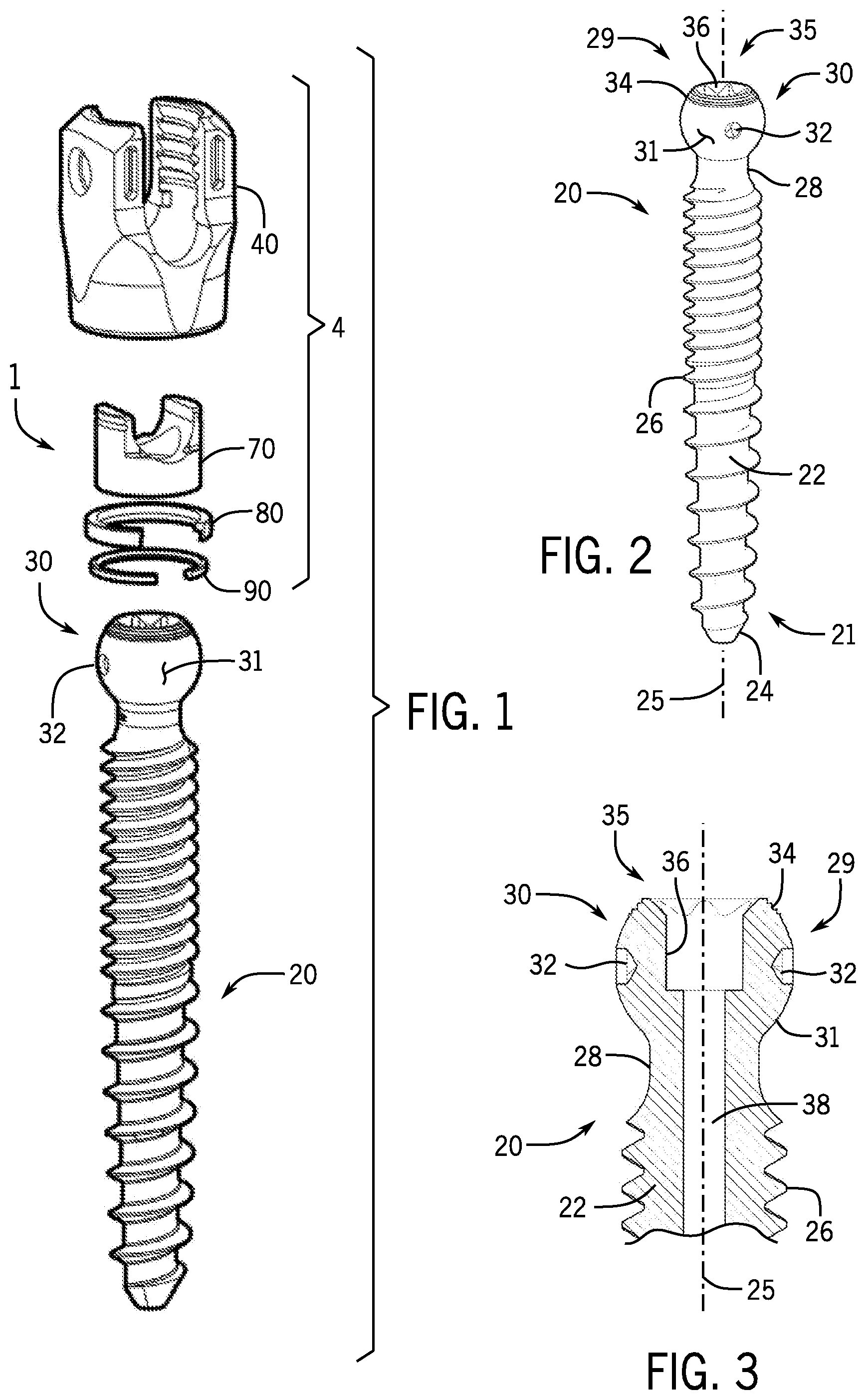 Patent US12167872 — Bottom loaded pivotal bone anchor assembly with locking and blocking rings and insert tool deployment — Figure 1
