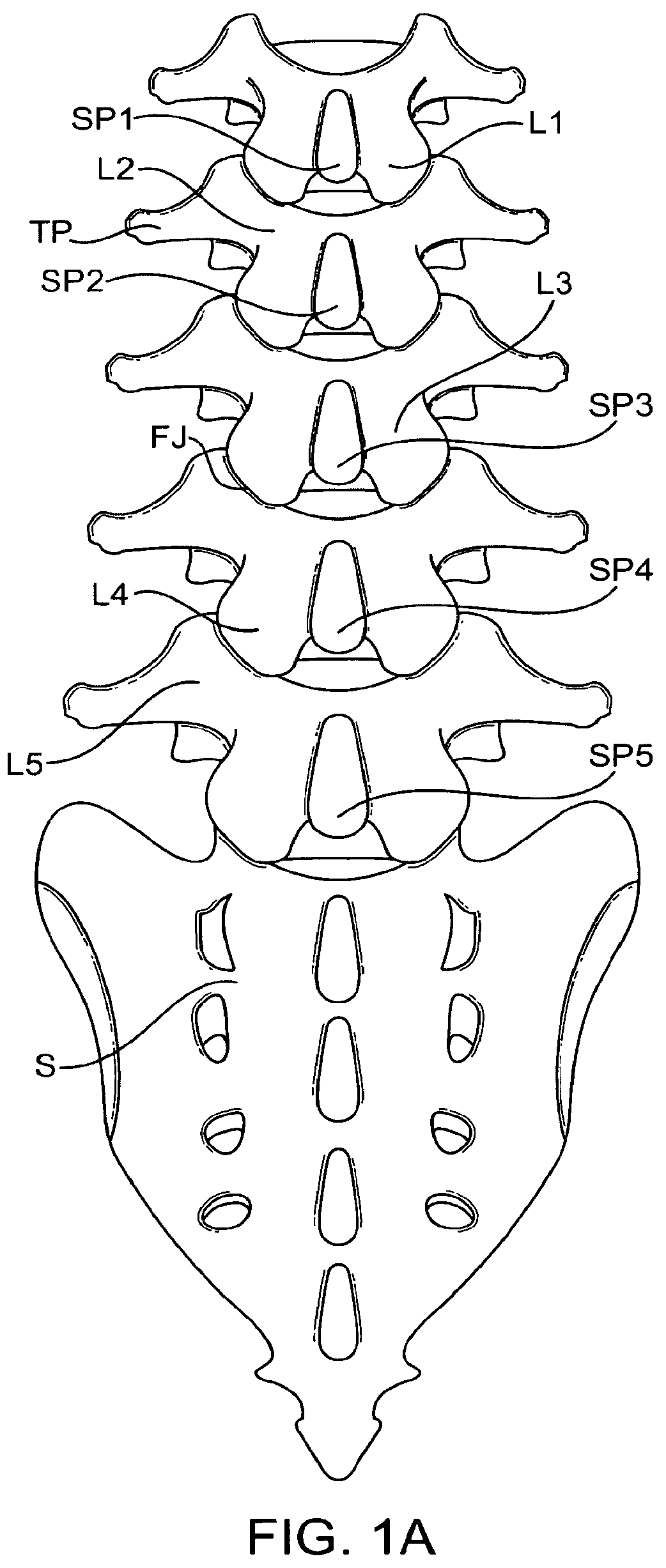 Patent US12167874 — Surgical tether apparatus and methods of use — Figure 1