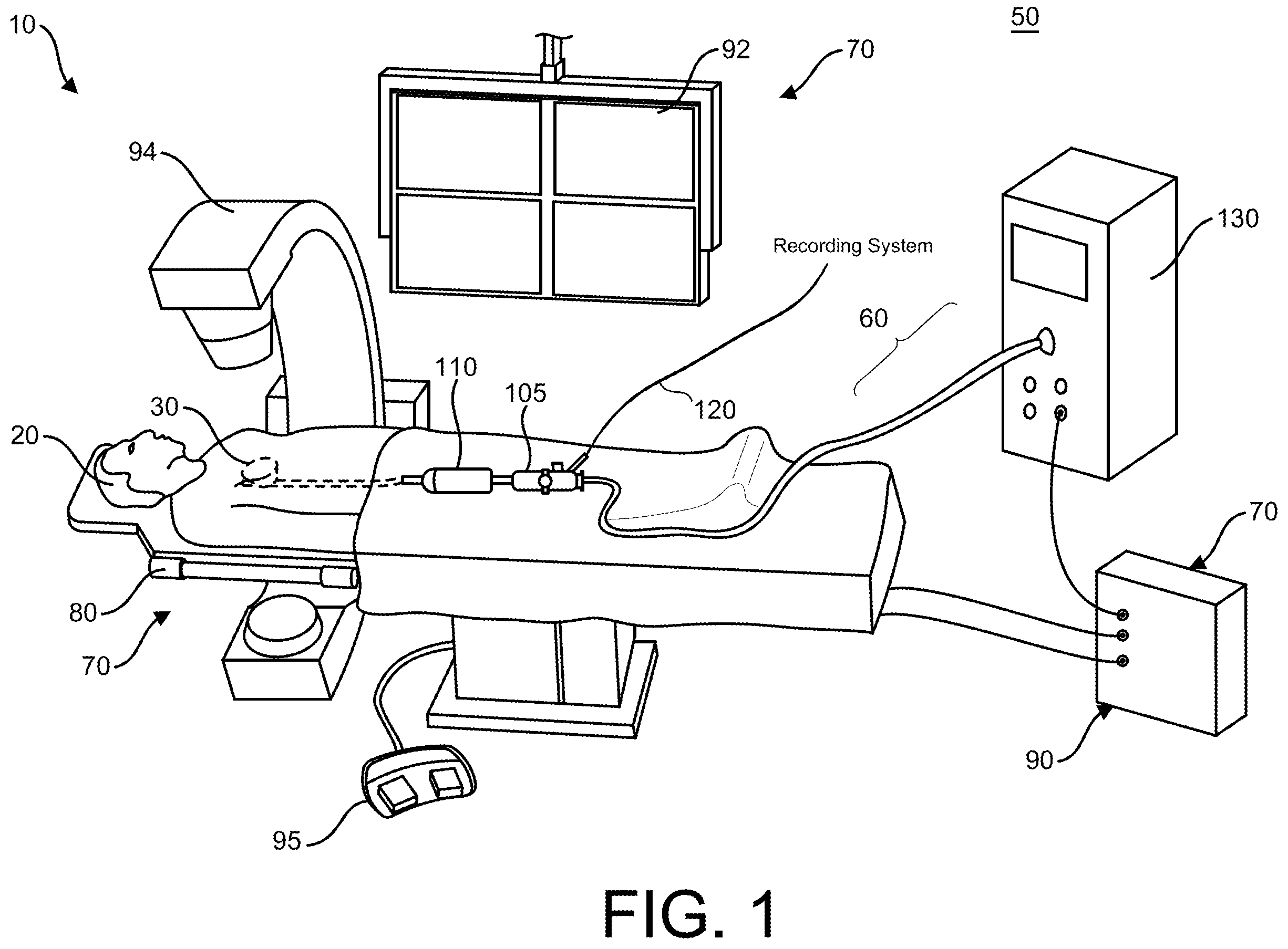 Patent US12167879 — Navigation-enabled cryoablation system with indirect device tracking — Figure 1