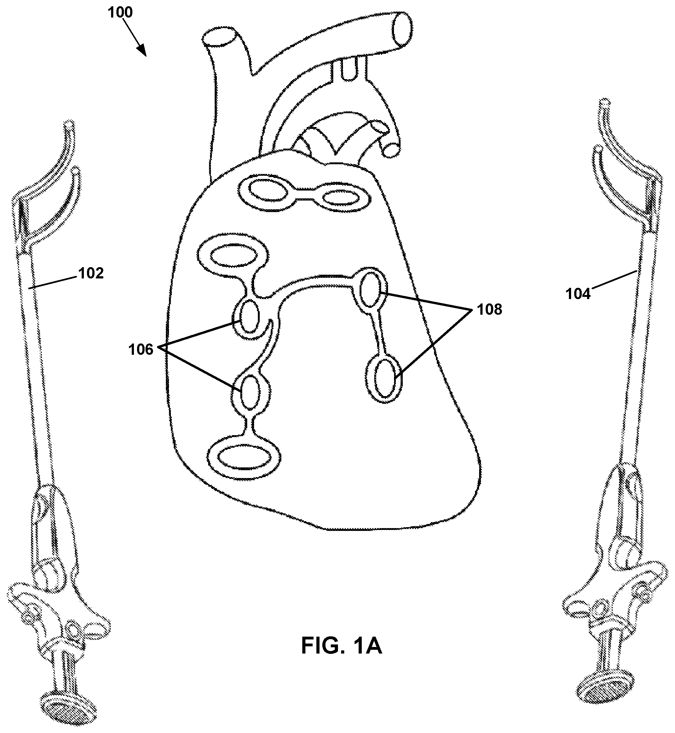 Patent US12167882 — Utilization of synergy EMR and EML to create a COXMAZE3 box lesion with radio frequency — Figure 1
