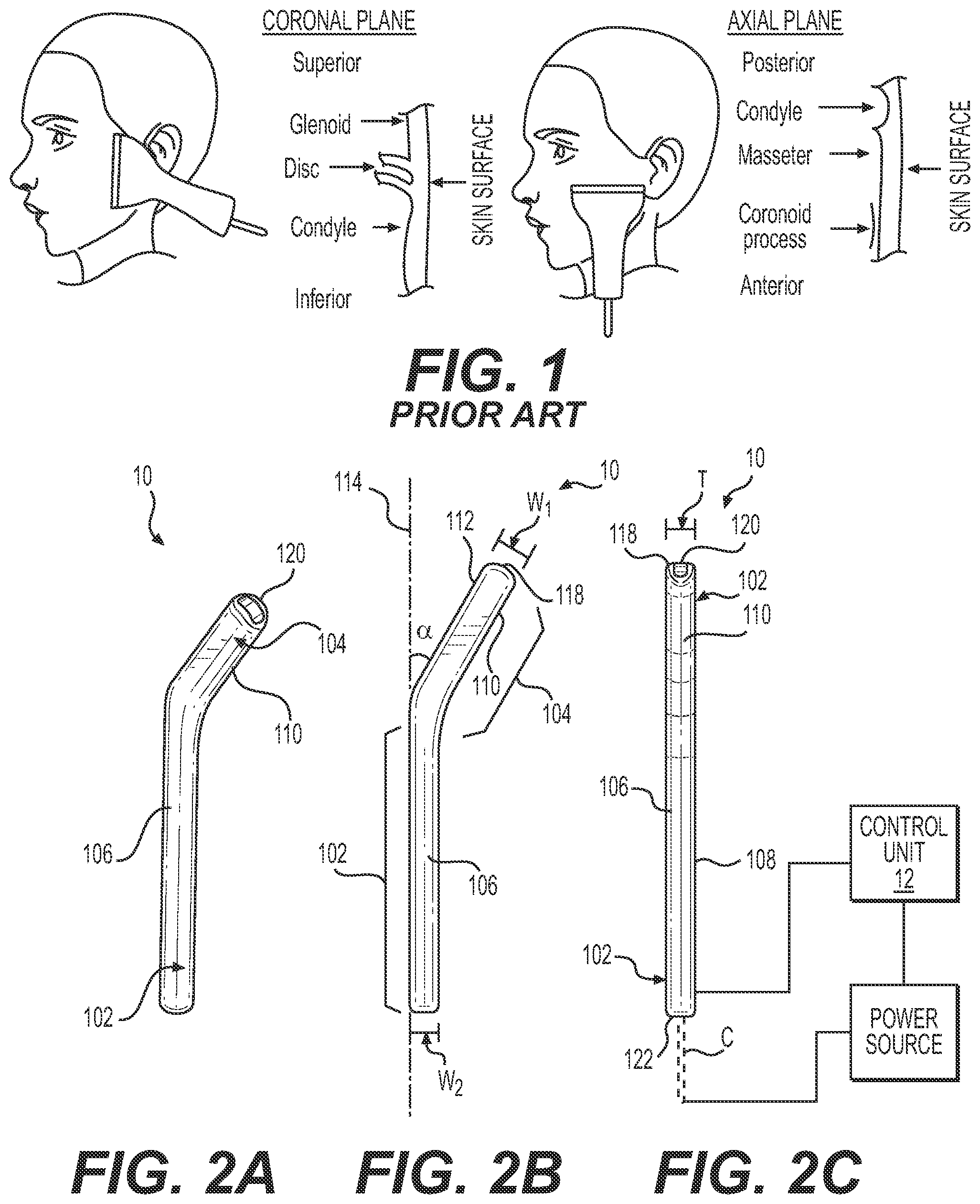 Patent US12167887 — Transoral ultrasound probe — Figure 1