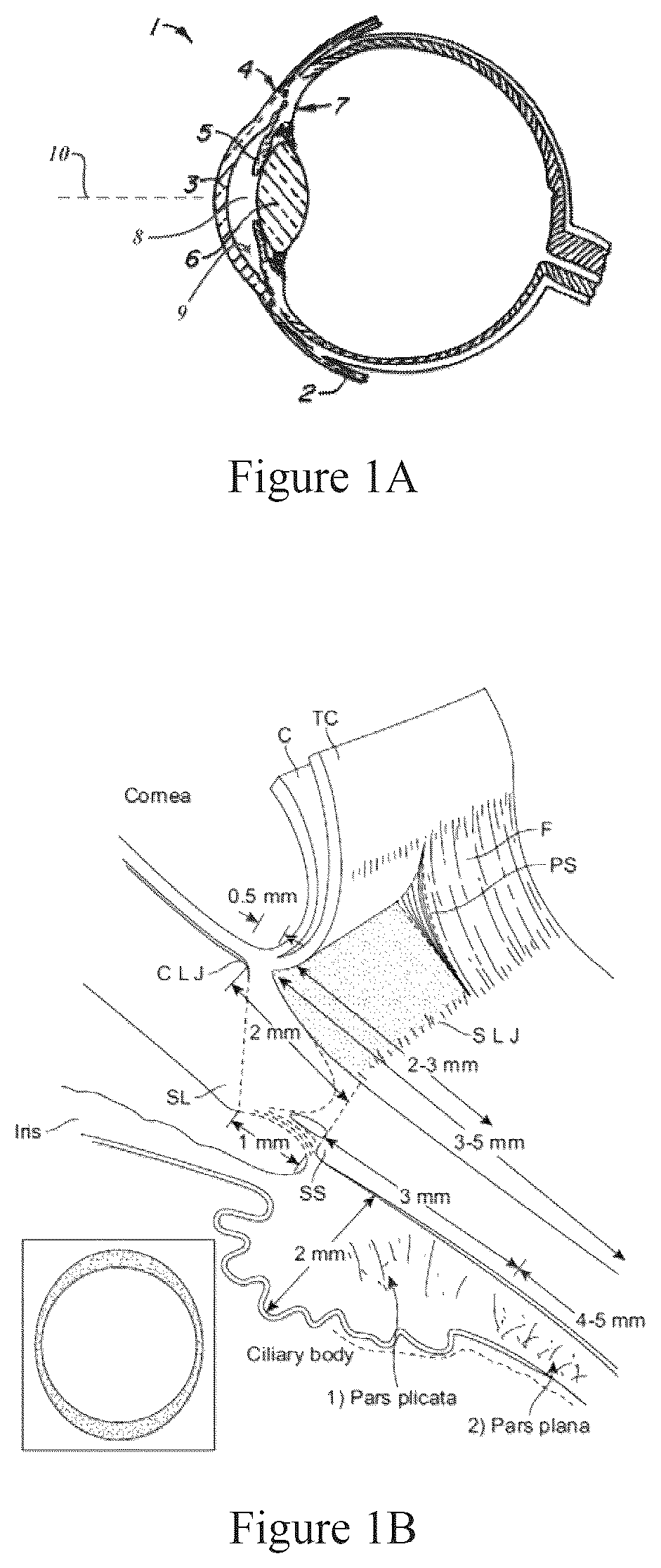 Patent US12167891 — Handheld ophthalmic laser system with replaceable contact tips and treatment guide — Figure 1
