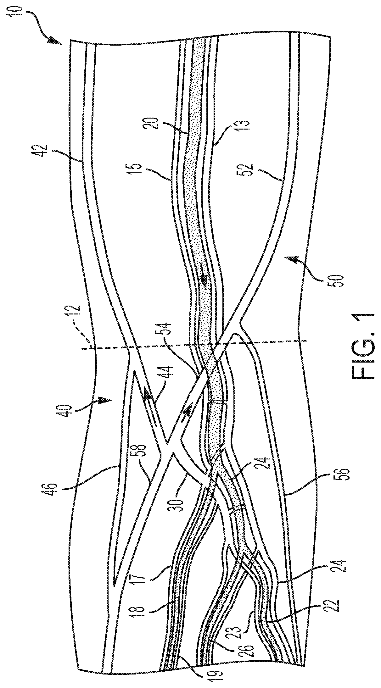 Patent US12167896 — Systems, methods, and catheters for endovascular treatment of a blood vessel — Figure 1