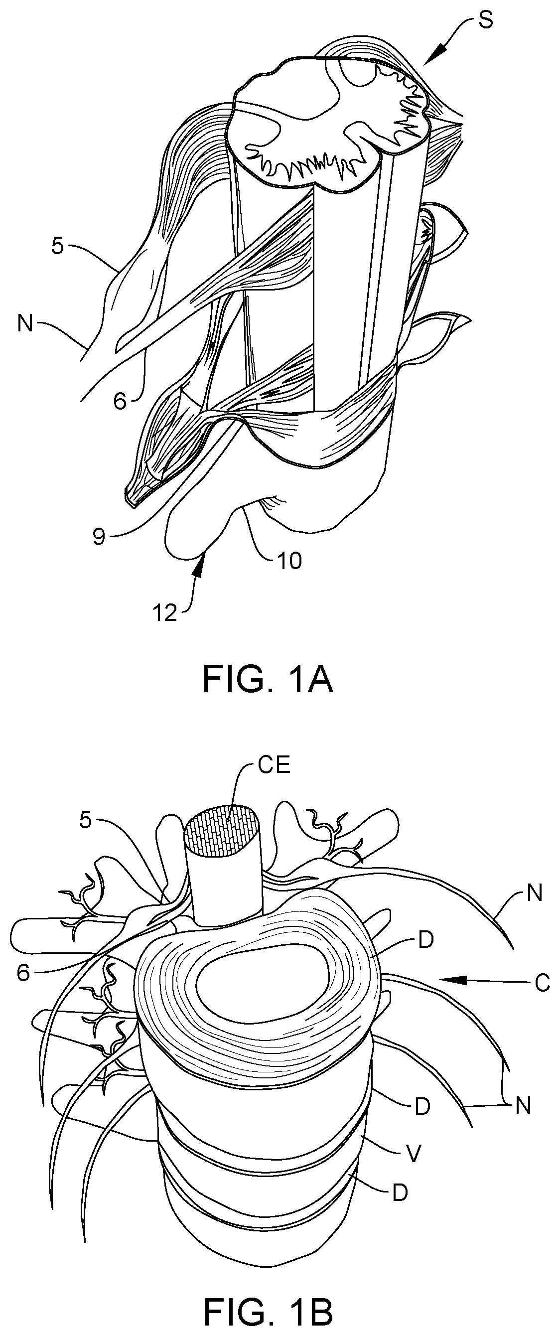 Patent US12167915 — Bipolar nerve stimulation/monitoring cuff — Figure 1