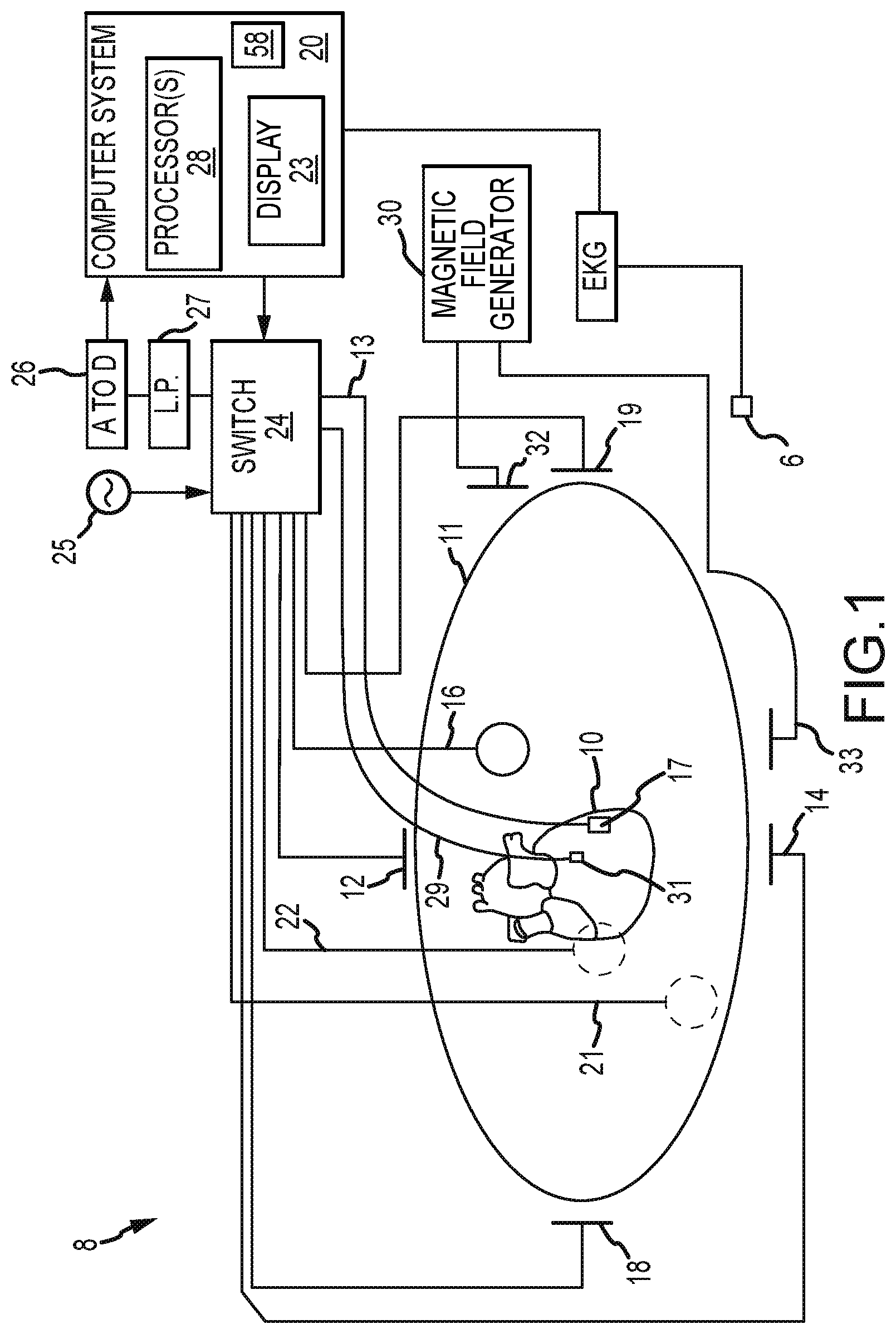 Patent US12167917 — System and method for detection and mapping of near field conduction in scar tissue — Figure 1